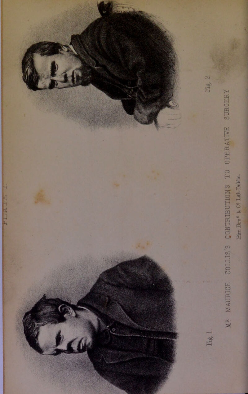 ri-.il.-i £i «on M? MAURICE COLLIS’S CONIRIBUTIQJ^S TO OPERATIVE SURGERY Pun Bro* k C° LitADabHa.