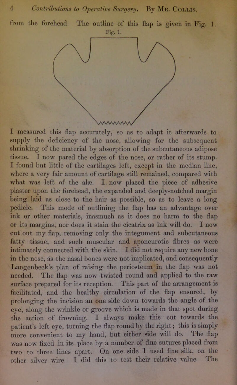 from the forehead. The outline of this flap is given in Fig. 1. Fig. 1. I measured this flap accurately, so as to adapt it afterwards to supply the deficiency of the nose, allowing for the subsequent slu’inking of the material by absorption of the subcutaneous adipose tissue. I now pared the edges of the nose, or rather of its stump. I found but little of the cartilages left, except in the median line, where a very fair amount of cartilage still remained, compared with what was left of the ahc. I now placed the piece of adhesive plaster upon the forehead, the expanded and deeply-natched margin being laid as close to the hair as possible, so as to leave a long pedicle. This mode of outlining the flap has an advantage over ink or other materials, inasmuch as it does no harm to the flap or its margins, nor does it stain the cicatrix as ink will do. I now cut out my flap, removing only the integument and subcutaneous fatty tissue, and such muscular and aponeurotic fibres as were intimately connected with the skin. I did not require any new bone in the nose, as the nasal bones were not implicated, and consequently Langenbeck’s plan of raising the periosteum in the flap was not needed. The flap was noAV twisted round and applied to the raw surface prepared for its reception. This part of the arrangement is facilitated, and the healthy circulation of the flap ensured, by prolonging the incision an one side down towards the angle of the eye, along the wrinkle or groove Avhich is made in that spot during the action of frowning. I always make this cut towards the patient’s left eye, turning the flap round by the right; this is simply more convenient to my hand, but either side will do. Phe flap was now fixed in its place by a number of fine sutures placed from two to three lines apart. On one side I used fine silk, on the other silver wire. I did this to test their relative value. The