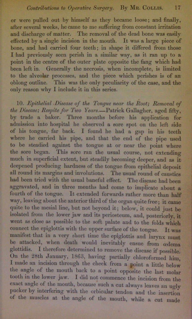 or were pulled out by himself as they became loose; and finally, after seveml weeks, he came to me suffering from eonstant irritation and discharge of matter. The removal of the dead bone was easily effected by a single incision in the mouth. It was a large piece of bone, and had carried four teeth; in shape it differed from those I had previously seen perish in a similar way, as it ran up to a point in the centre of the outer plate opfwsite the fang which had been left in. Generally the necrosis, when incomplete, is limited to the alveolar processes, and the piece which perishes is of an oblong outline. This was the only peeuliarity of the case, and the only reason why I include it in this series. 10. Epithelial Disease of the Tongue near the Root; Removal of the Disease; Respite for Two Years.—Patrick Gallagher, aged fifty, by trade a baker. Three months before his applieation for admission into hospital be obsened a sore spot on the left side of his tongue, far back. I found he had a gap in his teeth where he earried his pipe, and that the end of the pij>e used to be steadied against the tongue at or near the point where the sore began. This sore ran the usual eourse, not extending much in superficial extent, but steadily becoming deeper, and as it deepened producing hardness of the tongue from epithelial deposit all round its margins and involutions. The usual round of caustics had been tried with the usual baneful effeet. The disease had been aggravated, and in three months had come to implicate about a fourth of the tongue. It extended forwards rather more than half way, leaving about the anterior third of the organ quite free; it came quite to the mesial line, but not beyond it; below, it could just be isolated from the lower jaw and its periosteum, and, posteriorly, it went as elose as possible to the soft palate and to the folds which connect the epiglottis with the upper surface of the tongue. It was manifest that in a very short time the epiglottis and larynx must be attjicked, when tleath would inevitably ensue from oedema glottidis. I therefore determined to remove the disease if possible. On the 28th January, 1863, having partially chloroformed him, I made an incision through the cheek from a point a little below the angle of the mouth back to a point opposite the last molar tooth in the lower jaw. I did not commence the ineision from the exact angle of the mouth, beeause'sueh a cut always leaves an ugly pucker by interfering with the orbiciUar tendon and the insertfoii of the muscles at the angle of the mouth, while a eut made