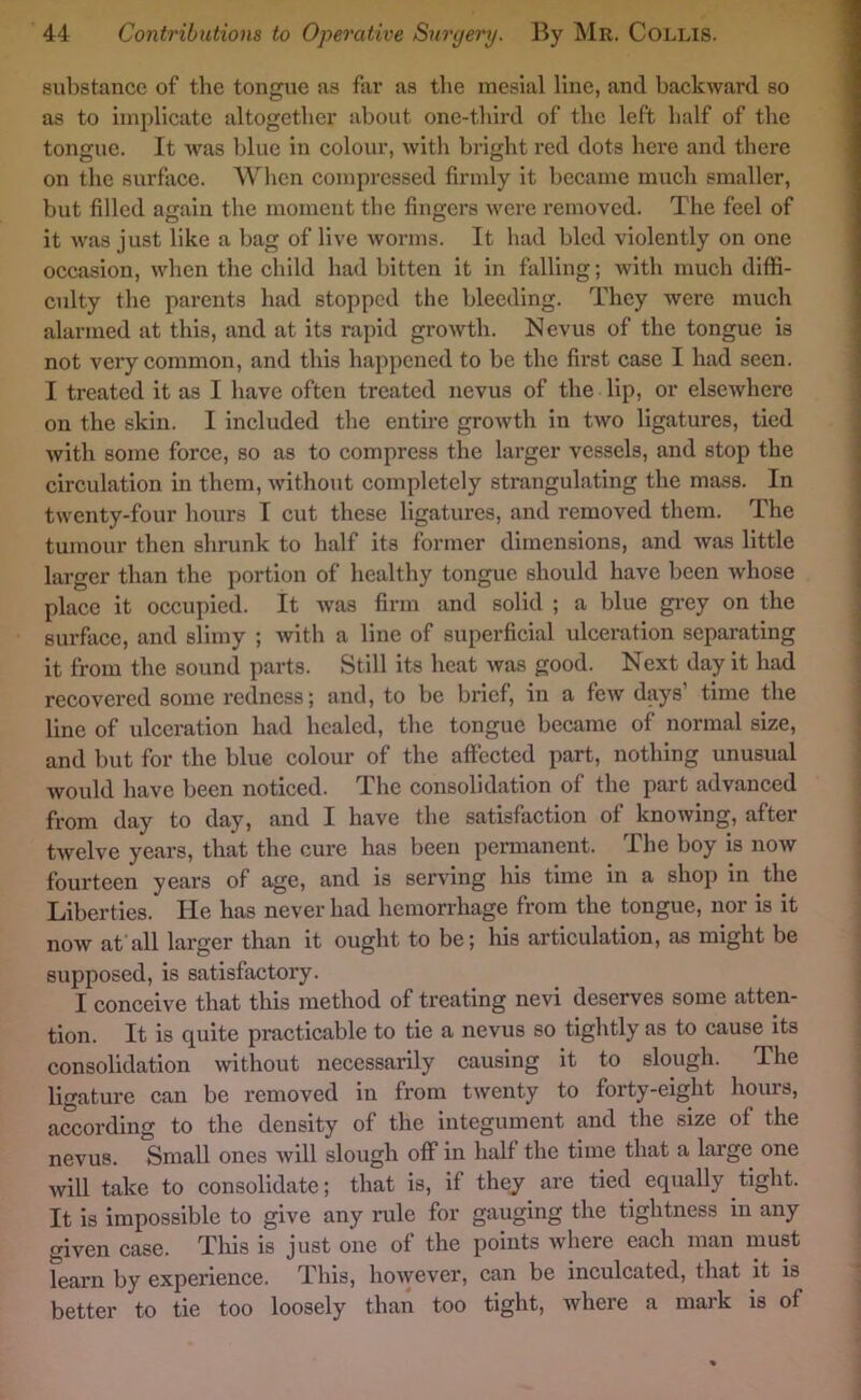 substance of the tongue as far as the mesial line, and backward so as to implicate altogether about one-third of the left half of the tongue. It was blue in colour, with bright red dots here and there on the surface. When compressed firmly it became much smaller, but filled again the moment the fingers were removed. The feel of it was just like a bag of live worms. It had bled violently on one occasion, when the child had bitten it in falling; with much diffi- culty the parents had stopped the bleeding. They were much alarmed at this, and at its rapid growth. Nevus of the tongue is not very common, and this happened to be the first case I had seen. I treated it as I have often treated nevus of the lip, or elsewhere on the skin. I included the entire growth in two ligatures, tied with some force, so as to compress the larger vessels, and stop the circulation in them, without completely strangulating the mass. In twenty-four hours I cut these ligatures, and removed them. The tumour then shrunk to half its former dimensions, and was little larger than the portion of healthy tongue should have been Avhose place it occupied. It was firm and solid ; a blue gi’ey on the surface, and slimy ; with a line of superficial ulceration separating it from the sound parts. Still its heat was good. Next day it had recovered some redness; and, to be brief, in a few days’ time the line of ulceration had healed, the tongue became of normal size, and but for the blue colour of the affected part, nothing unusual would have been noticed. The consolidation of the part advanced from day to day, and I have the satisfaction of knowing, after twelve years, that the cure has been permanent. The boy is now fourteen years of age, and is serving his time in a shop in the Liberties. He has never had hemorrhage from the tongue, nor is it now at all larger than it ought to be; his articulation, as might be supposed, is satisfactory. I conceive that this method of treating nevi deserves some atten- tion. It is quite practicable to tie a nevus so tightly as to cause its consolidation without necessarily causing it to slough. The ligature can be removed in from twenty to forty-eight hours, aSording to the density of the integument and the size of the nevus. Small ones will slough off in half the time that a large one will take to consolidate; that is, if they are tied equally tight. It is impossible to give any rule for gauging the tightness in any given case. This is just one of the points Avhere each man must learn by experience. This, however, can be inculcated, that it is better to tie too loosely than too tight, where a mark is of