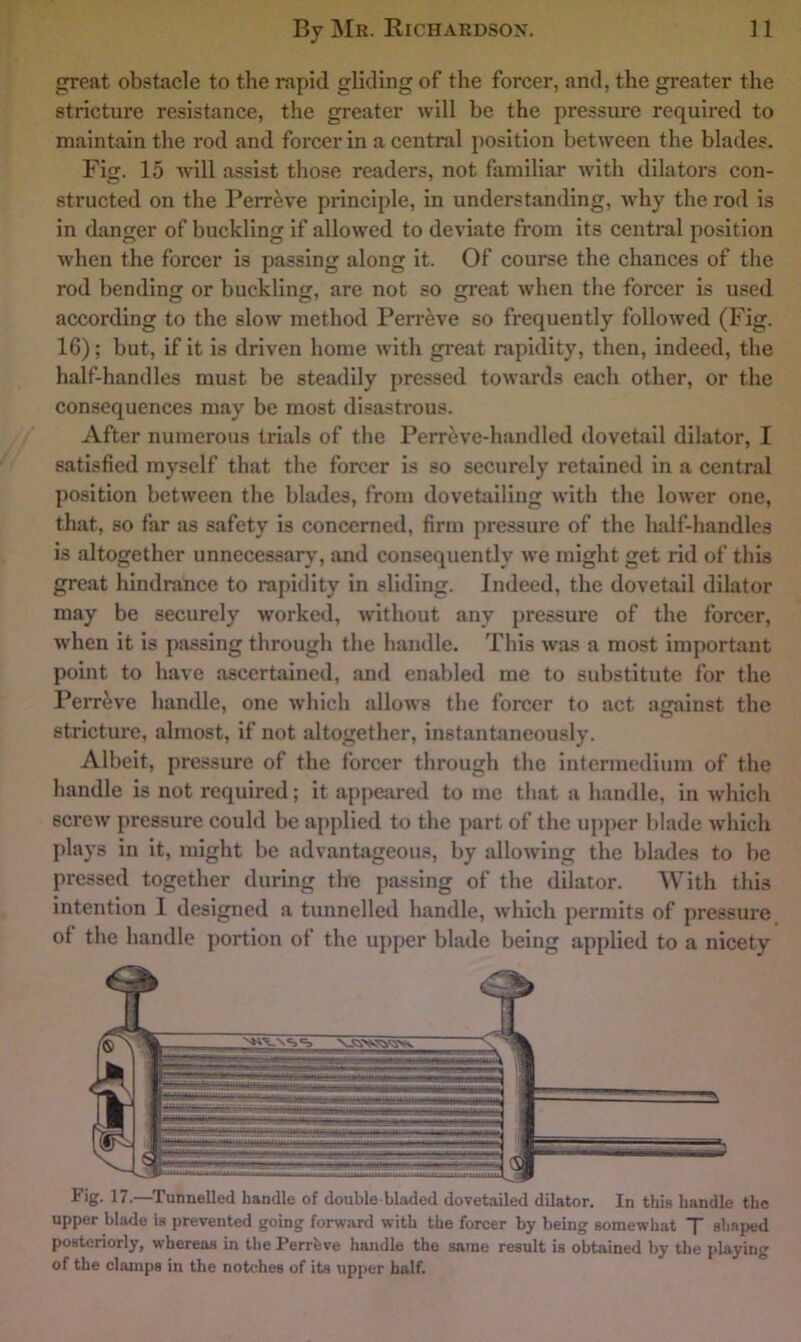 great obstacle to the rapid gliding of the forcer, and, the greater the stricture resistance, the greater will be the pressure required to maintain the rod and forcer in a central position between the blades. Fig. 15 will assist those readers, not familiar with dilators con- structed on the Perr^ve principle, in understanding, why the rod is in danger of buckling if allowed to deviate from its central position when the forcer is passing along it. Of course the chances of the rod bending or buckling, are not so great when the forcer is used according to the slow method Perr^ve so frequently followed (Fig. 16); but, if it is driven home with great rapidity, then, indeed, the half-handles must be steadily pressed towards each other, or the consequences may be most disastrous. After numerous trials of the Perr^ve-handlcd dovetail dilator, I satisfied myself that the forcer is so securely retained in a central position between the blades, from dovetiiiling with the lower one, that, so far as safety is concerned, firm pressure of the half-handles is altogether unnecessary, and consequently we might get rid of this great hindranee to rapidity in sliding. Indeed, the dovetail dilator may be securely worked, without any pressure of the forcer, when it is passing through the handle. This was a most important point to have ascertained, and enabled me to substitute for the Perr^ve handle, one which allows the forcer to act against the stricture, almost, if not altogether, instantaneously. Albeit, pressure of the forcer through the intermedium of the handle is not required; it appeared to me that a handle, in which screw pressure could be applied to the j)art of the upper blade which plays in it, might be advantageous, by allowing the blades to be pressed together during the passing of the dilator. With this intention I designed a tunnelled handle, which permits of pressure of the handle j)ortion of the upper blade being applied to a nicety Fig. 17.—Tunnelled handle of double bladed dovetailed dilator. In this handle the upper blade is prevented going forward with the forcer by being somewhat T shaped posteriorly, whereas in the Perrbve handle the same result is obtained by the playing of the clamps in the notches of its upper half.