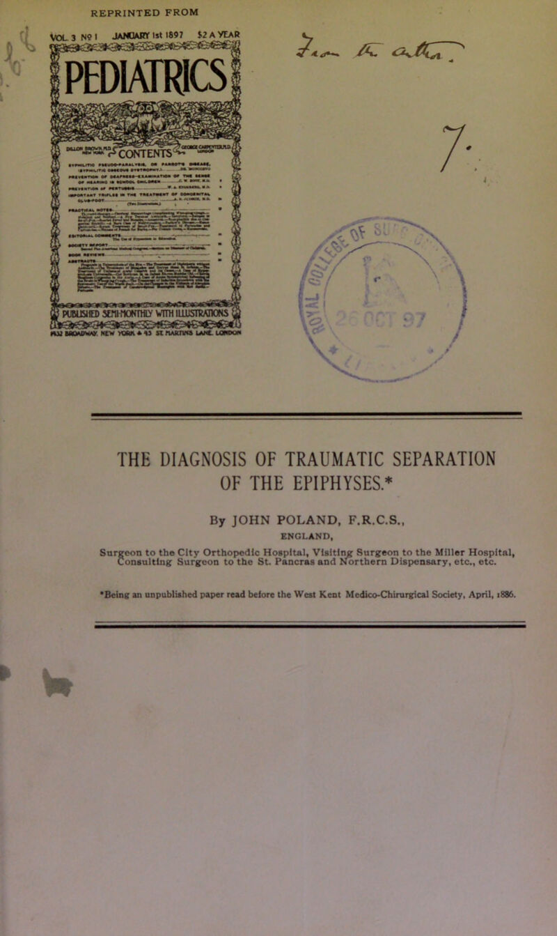 REPRINTED FROM ^CONTENTS published sEfUMOKmiy vim luusnwnoNS VOL 3 NO I JANOAHY 1st 1897 $2 A YEAR m2 MOADW* NEW yoftn *« si kartvcs lane. London £ a: ^/«CT THE DIAGNOSIS OF TRAUMATIC SEPARATION OF THE EPIPHYSES* By JOHN POLAND, F.R.C.S., ENGLAND, Surgeon to the City Orthopedic Hospital, Visiting Surgeon to the Miller Hospital, Consulting Surgeon to the St. Pancras and Northern Dispensary, etc., etc. ‘Being an unpublished paper read beiore the West Kent Medico-Chirurgical Society, April, 1886. w