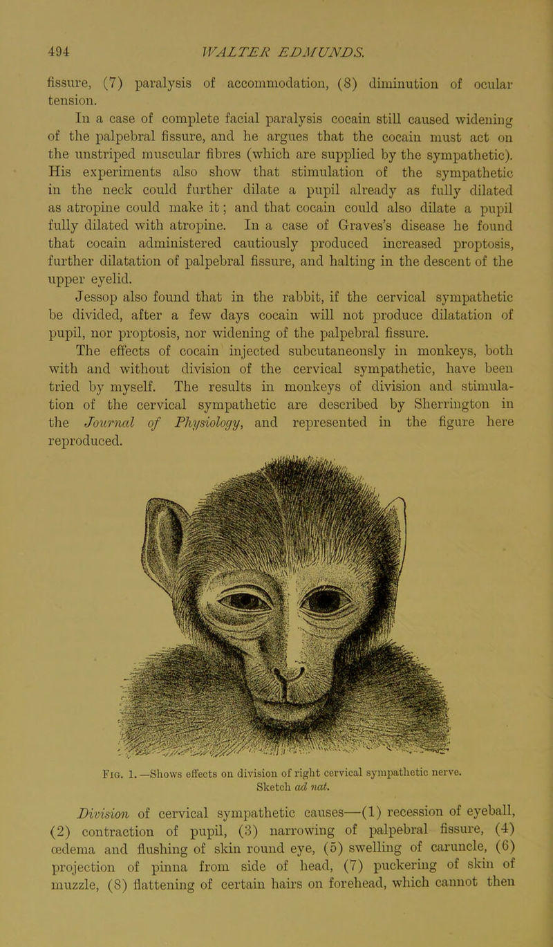 fissure, (7) paralysis of accoinniodation, (8) diminution of ocular tension. In a case of complete facial paralysis cocain still caused widening of the palpebral fissure, and he argues that the cocain must act on the unstriped muscular fibres (which are supplied by the sympathetic). His experiments also show that stimulation of the sympathetic in the neck could further dilate a pupil already as fully dilated as atropine could make it; and that cocain could also dilate a pupil fully dilated with atropine. In a case of Graves’s disease he found that cocain administered cautiously produced increased proptosis, further dilatation of palpebral fissure, and halting in the descent of the upper eyelid. Jessop also found that in the rabbit, if the cervical sympathetic be divided, after a few days cocain will not produce dilatation of pupil, nor proptosis, nor widening of the palpebral fissure. The effects of cocain injected subcutaneonsly in monkeys, both with and without division of the cervical sympathetic, have been tried by myself. The results in monkeys of division and stimula- tion of the cervical sympathetic are described by Sherrington in the Journal of Physiology, and represented in the figure here reproduced. Fig. 1. —Shows effects on division of right cervical sympathetic nerve. Sketch ad ncd. Division of cervical sympathetic causes—(1) recession of eyeball, (2) contraction of pupil, (3) narrowing of palpebral fissure, (4) oedema and flushing of skin round eye, (5) swelling of caruncle, (6) projection of pinna from side of head, (7) puckering of skin of muzzle, (8) flattening of certain hairs on forehead, which cannot then