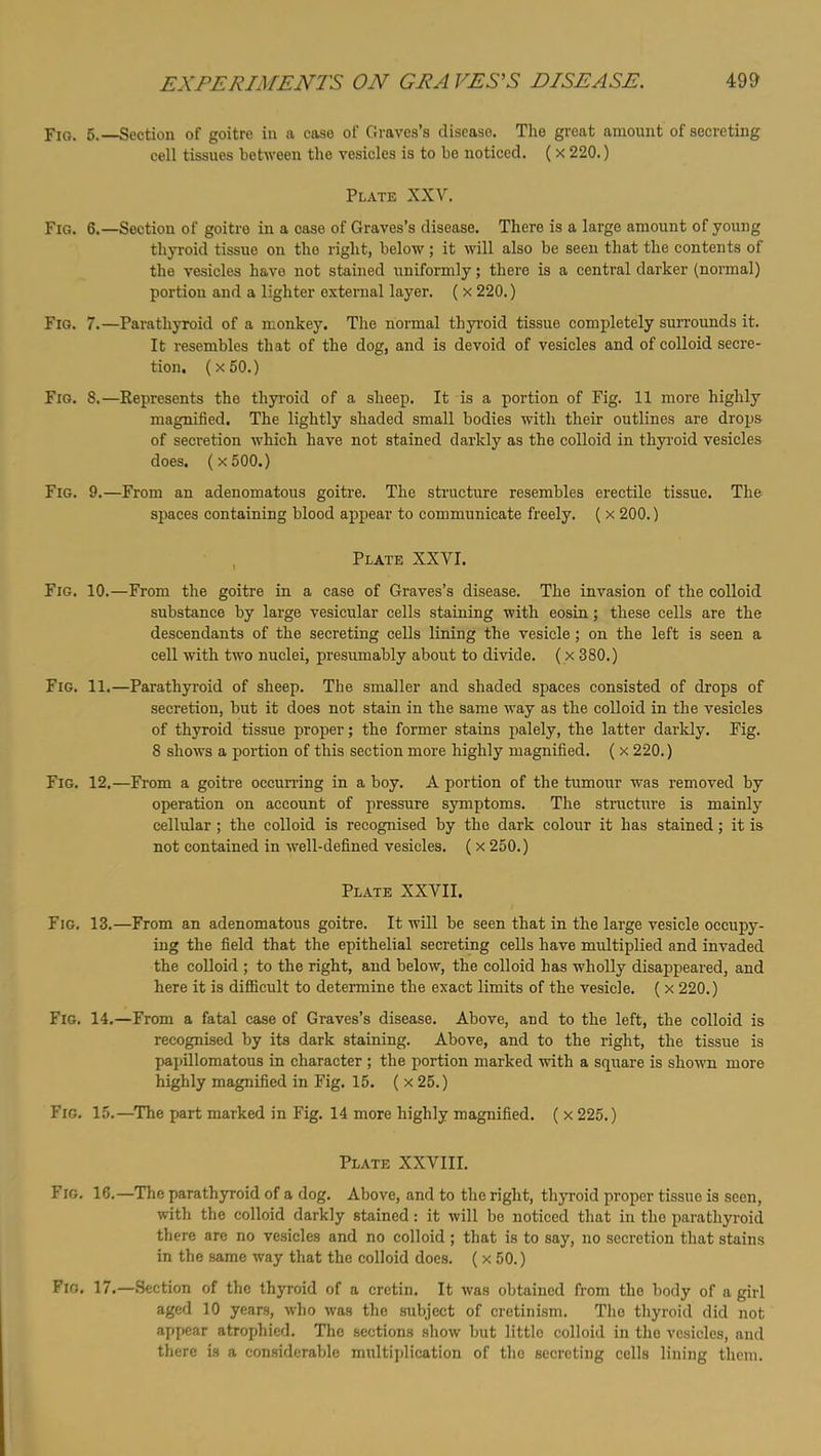 Fig. 5, Section of goitre in a case of Graves’s disease. The great amount of secreting cell tissues between the vesicles is to bo noticed. ( x 220.) Plate XXV. Fig. 6.—Section of goitre in a case of Graves’s disease. There is a large amount of young thyroid tissue on the right, below; it will also be seen that the contents of the vesicles have not stained uniformly; there is a central darker (normal) portion and a lighter external layer. ( x 220.) Fig. 7.—Parathyroid of a monkey. The normal thyroid tissue completely surroimds it. It resembles that of the dog, and is devoid of vesicles and of colloid secre- tion. (x50.) Fig. 8.—Eepresents the thyroid of a sheep. It is a portion of Fig. 11 more highly magnified. The lightly shaded small bodies with their outlines are drops of secretion which have not stained darkly as the colloid in thyi'oid vesicles does. (x500.) Fig. 9.—From an adenomatous goitre. The structure resembles erectile tissue. The spaces containing blood appear to communicate freely. ( x 200.) Plate XXVI. Fig. 10.—From the goitre in a case of Graves’s disease. The invasion of the colloid substance by large vesicular cells staining with eosin; these cells are the descendants of the secreting cells lining the vesicle; on the left is seen a cell with two nuclei, presumably about to divide. (x 380.) Fig. 11.—Parathyroid of sheep. The smaller and shaded spaces consisted of drops of secretion, but it does not stain in the same way as the colloid in the vesicles of thyroid tissue proper; the former stains palely, the latter darkly. Fig. 8 shows a portion of this section more highly magnified. ( x 220.) Fig. 12.—From a goitre occurring in a boy. A portion of the tumour was removed by operation on account of pressure symptoms. The structure is mainly cellular ; the colloid is recognised by the dark colour it has stained; it is not contained in well-defined vesicles. ( x 250.) Plate XXVII. Fig. 13.—From an adenomatous goitre. It will be seen that in the large vesicle occupy- ing the field that the epithelial secreting cells have multiplied and invaded the colloid ; to the right, and below, the colloid has wholly disappeared, and here it is difficult to determine the exact limits of the vesicle. (x 220.) Fig. 14.—From a fatal case of Graves’s disease. Above, and to the left, the colloid is recognised by its dark staining. Above, and to the right, the tissue is papillomatous in character; the portion marked with a square is shown more highly magnified in Fig. 15. ( x 25.) Fig. 15.—’The part marked in Fig. 14 more highly magnified. ( x 225.) Plate XXVIII. Fig, 16.—The parathyroid of a dog. Above, and to the right, thyroid proper tissue is seen, with the colloid darkly stained: it will bo noticed that in the parathyroid there are no vesicles and no colloid; that is to say, no secretion that stains in the same way that the colloid does. ( x 50.) Fig. 17.—Section of the thyroid of a cretin. It was obtained from the body of a girl aged 10 years, who was the subject of cretinism. The thyroid did not appear atrophied. The sections show but little colloid in the vesicles, and there is a considerable multijdication of the secreting cells lining them.