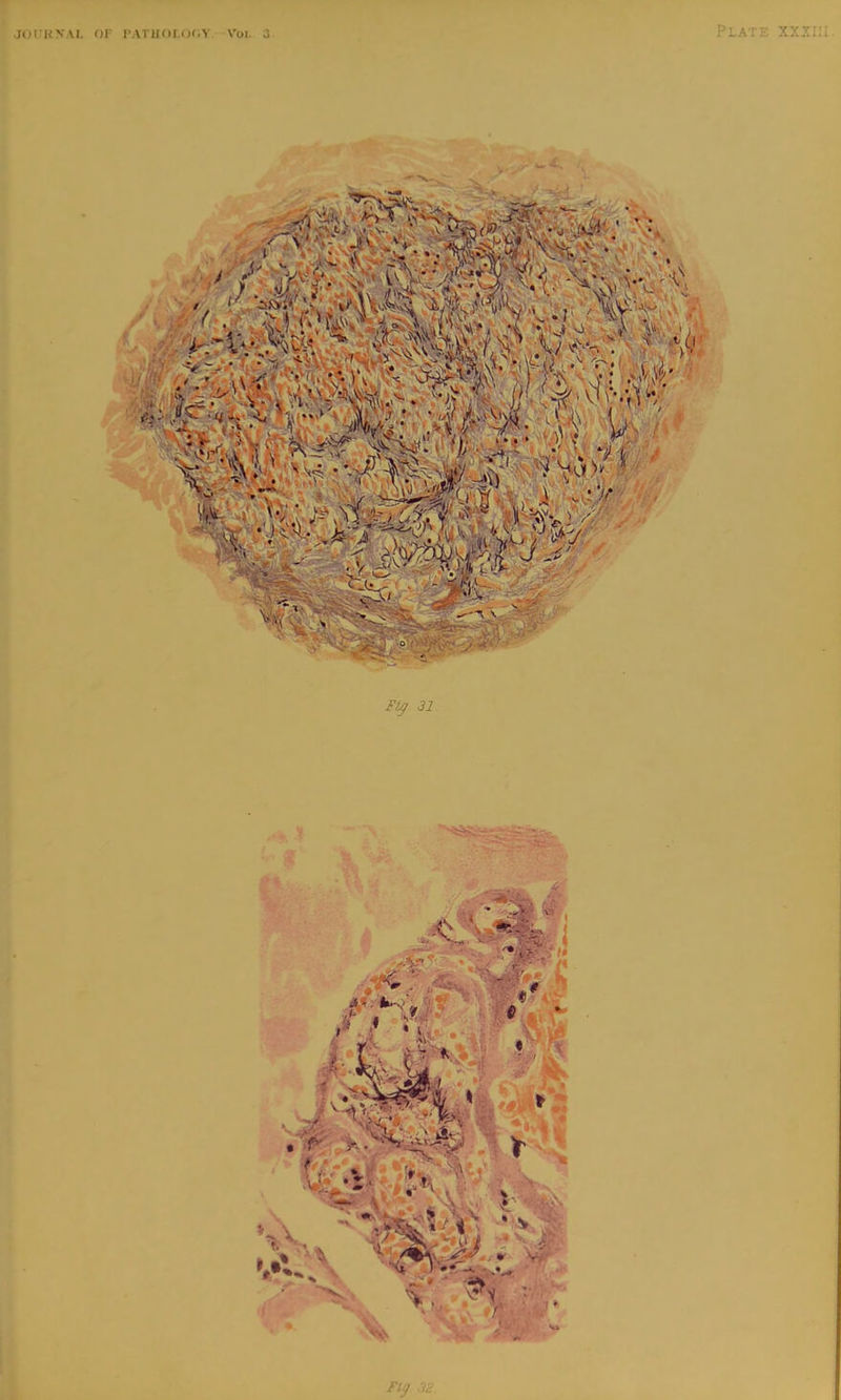 JorHNAI. OF I’ATHOI.OOY Voi. 3