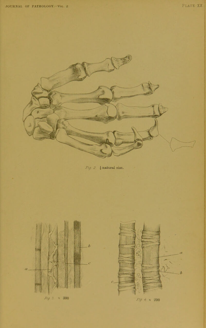 Plate XX , ! j Fig. 2 ^ natural size. I ]