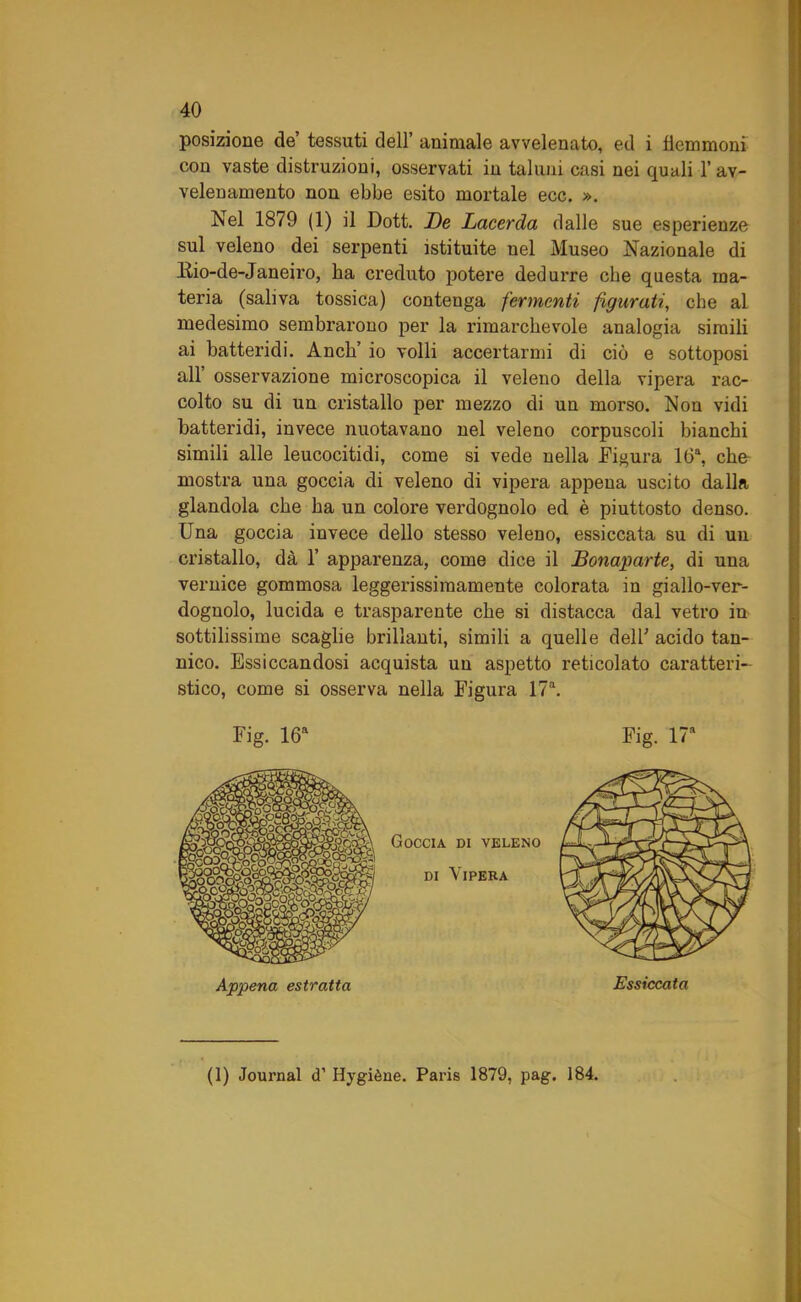 posizione de’ tessuti dell’ animale avvelenato, ed i flemmoni con vaste distruzioni, osservati in taluni casi nei quali l’av- velenamento non ebbe esito mortale ecc. ». Nel 1879 (1) il Dott. De Lacerda dalle sue esperienze sul veleno dei serpenti istituite nel Museo Nazionale di Bio-de-Janeiro, ha creduto potere dedurre che questa ma- teria (saliva tossica) contenga fermenti figurati, che al medesimo sembrarono per la rimarchevole analogia simili ai batteridi. Anch’ io volli accertarmi di ciò e sottoposi all’ osservazione microscopica il veleno della vipera rac- colto su di un cristallo per mezzo di un morso. Non vidi batteridi, invece nuotavano nel veleno corpuscoli bianchi simili alle leucocitidi, come si vede nella Figura 16\ che mostra una goccia di veleno di vipera appena uscito dalla glandola che ha un colore verdognolo ed è piuttosto denso. Una goccia invece dello stesso veleno, essiccata su di un cristallo, dà 1’ apparenza, come dice il Bonaparte, di una vernice gommosa leggerissimamente colorata in giallo-ver- dognolo, lucida e trasparente che si distacca dal vetro in sottilissime scaglie brillanti, simili a quelle delU acido tan- nico. Essiccandosi acquista un aspetto reticolato caratteri- stico, come si osserva nella Figura 17\ (1) Journal d’ Hygiène. Paris 1879, pag. 184.