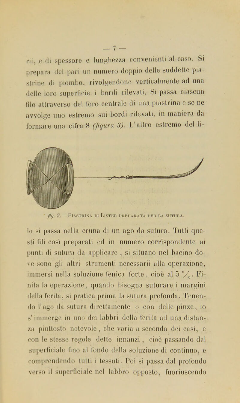 rii, c di spessore c lunghezza convenienti al caso. Si prepara ilei pari mi numero doppio delle suddette pia- strine di piombo, rivolgendone verticalmente ad una delle loro superlicie i bordi rilevati. Si passa ciascun Ilio attraverso del loro centrale di una piastrina c se ne avvolge uno estremo sui bordi rilevati, in maniera da formare una cifra 8 (figura S). L’altro estremo del li- * fìQ. 3.— Piastrina ni Lister riiErARATA per la sutura. lo si passa nella cruna di un ago da sutura. Tutti rpie- sti fili così preparati cd in numero corrispondente ai punti di sutura da applicare , si situano nel bacino do- ve sono gli altri strumenti necessarii alla operazione, immersi nella soluzione fenica forte, cioè al 5 Vo. Fi- nita la operazione, quando bisogna suturare i margini della ferita, si pratica prima la sutura profonda. Tenen- do l’ago da sutura direttamente o con delle pinze, lo s’immerge in uno dei labbri della ferita ad una distan- za piuttosto notevole, che varia a seconda dei casi, e con le stesse regole dette innanzi, cioè passando dal siqierficiale fino al fondo della soluzione di continuo, e romiircndcndo tutti i tessuti. Poi si passa dal profondo verso il superficiale nel labbro opposto, fuoriuscendo