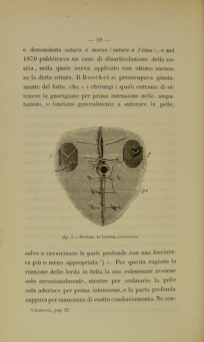 e denominala sutura a morsa {suture à l'étau)^ c nel 1870 pubblicava un caso di disarticolazione della co- scia , nella quale aveva applicalo con ollimo succes- so la della sutura. Il lioeckel si preoccupava giusla- mente del fallo, che « i chirurgi i (juali cercano di ot- tenere la guarigione per prima intensione nelle ampu- tazioni, si limitano generalmente a suturare la pelle. fig. -1 —Sutura m Listkr aitlicata. salvo a ravvicinare le parli profonde con una fasciatu- ra più o meno appropriala ') ». Per questa ragione la riunione delle ferita in tutta la sua estensione avviene solo eccezionalmente, mentre per ordinario la pelle sola aderisce per prima intensione, e la parte profonda suppura per mancanza di esalto combaciamento, INe con- ') Loco cit., pag. 12.