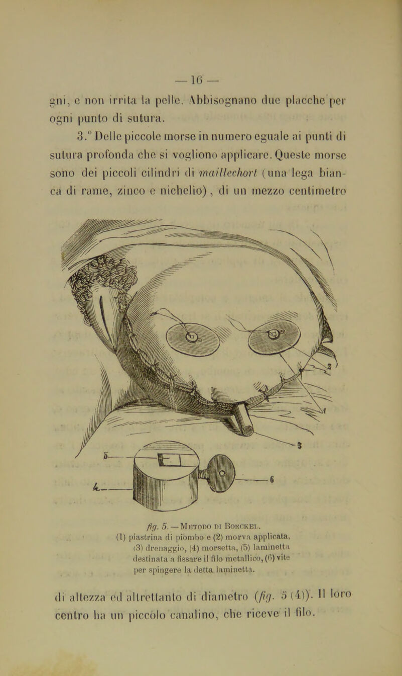 —1() — gni, c non irrita la pelle. Abbisognano due placche per ogni punto di sutura. 3. Delle piccole morse in numero eguale ai punti di sutura profonda che si vogliono applicare. Duestc morse sono dei piccoli cilindri di maitlechorl (una lega bian- ca di rame, zinco c nichelio), di un mezzo centimetro /><;. 5. — Mktodo ni Boi-inKEi.. (l) piastrina di piombo e (2) morva applicata. (3) drenaggio, (4) monsetta, (5) larainctta destinata a (issare il filo metallico, (fi) vite per spingere la detta laminetta. di altezza ed altrettanto di diametro (////. 5(iì). H loro centro ha un piccolo canalino, die riceve il filo.