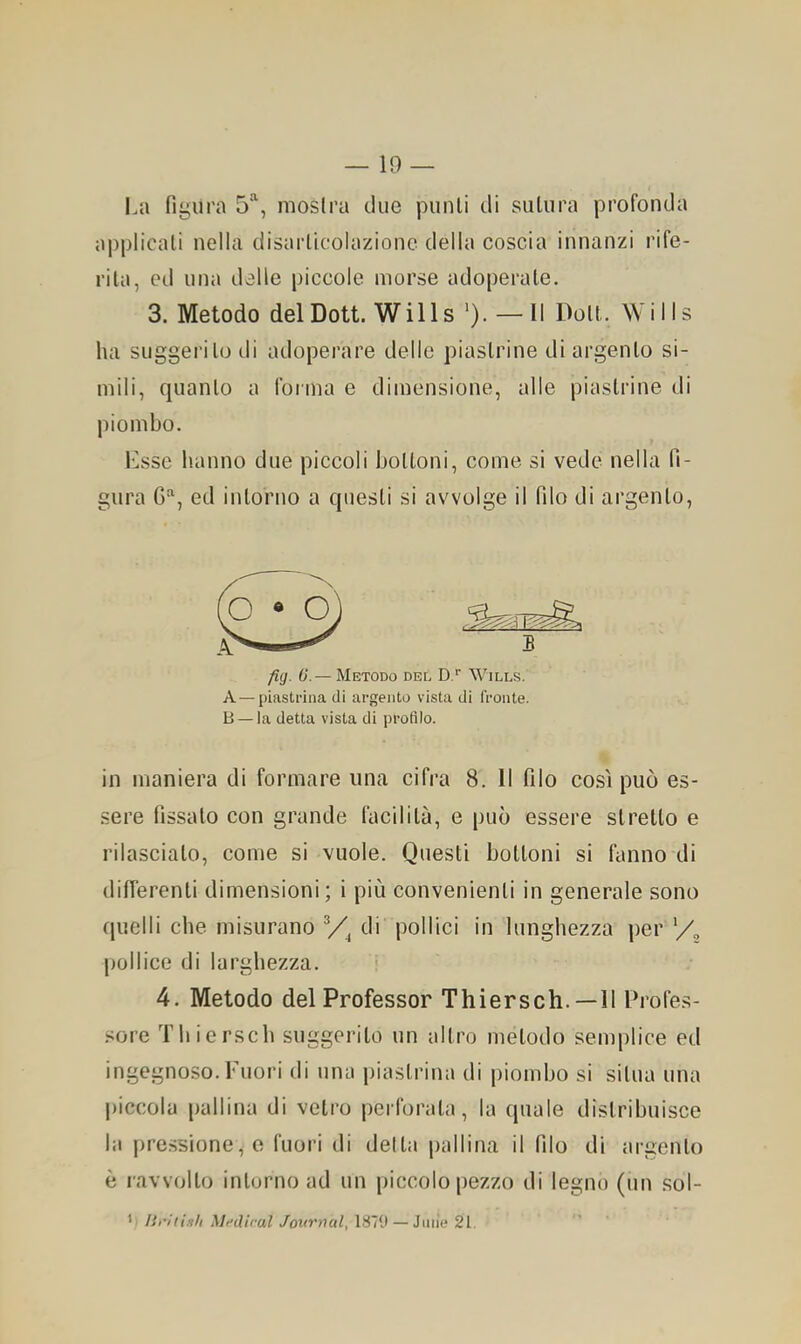 10 — La fiijiira 5“^, moslra tlue punii di sutura profonda applicali nella disarllcolazionc della coscia innanzi rife- rita, ed una delle piccole morse adoperale. 3. Metodo delDott. Wills —Il Doli. Wills ha suggerito ili adoperare delle piastrine di argento si- mili, quanto a forma e dimensione, alle piastrine di piombo. l'asse hanno due piccoli bottoni, come si vede nella fi- gura 6^, ed intorno a questi si avvolge il filo di ai'genlo. fiij. 0.— Metodo del D.*’ Wills. A — pLastrina di argento vista di fronte. B — la detta vista di profilo. in maniera di formare una cifi’a 8. Il filo così può es- sere fissalo con grande facilità, e può essere stretto e rilascialo, come si vuole. Questi bottoni si fanno di differenti dimensioni; i più convenienti in generale sono quelli che misurano di pollici in lunghezza per '/e pollice di lai’ghezza. i 4. Metodo del Professor Thiersch.—11 Profes- sore Thiersch suggerito un altro metodo semplice ed ingegnoso.Fuori di una iriaslrina di piombo si situa una piccola pallina di veti’o perfoi’ata, la quale distribuisce la pressione, e fuori di della pallina il filo di argento è ravvolto intorno ad un piccolo pezzo di legno (un .sol- r liriiinli Mfiliral Journal, 1870 — Jiiiie 21,