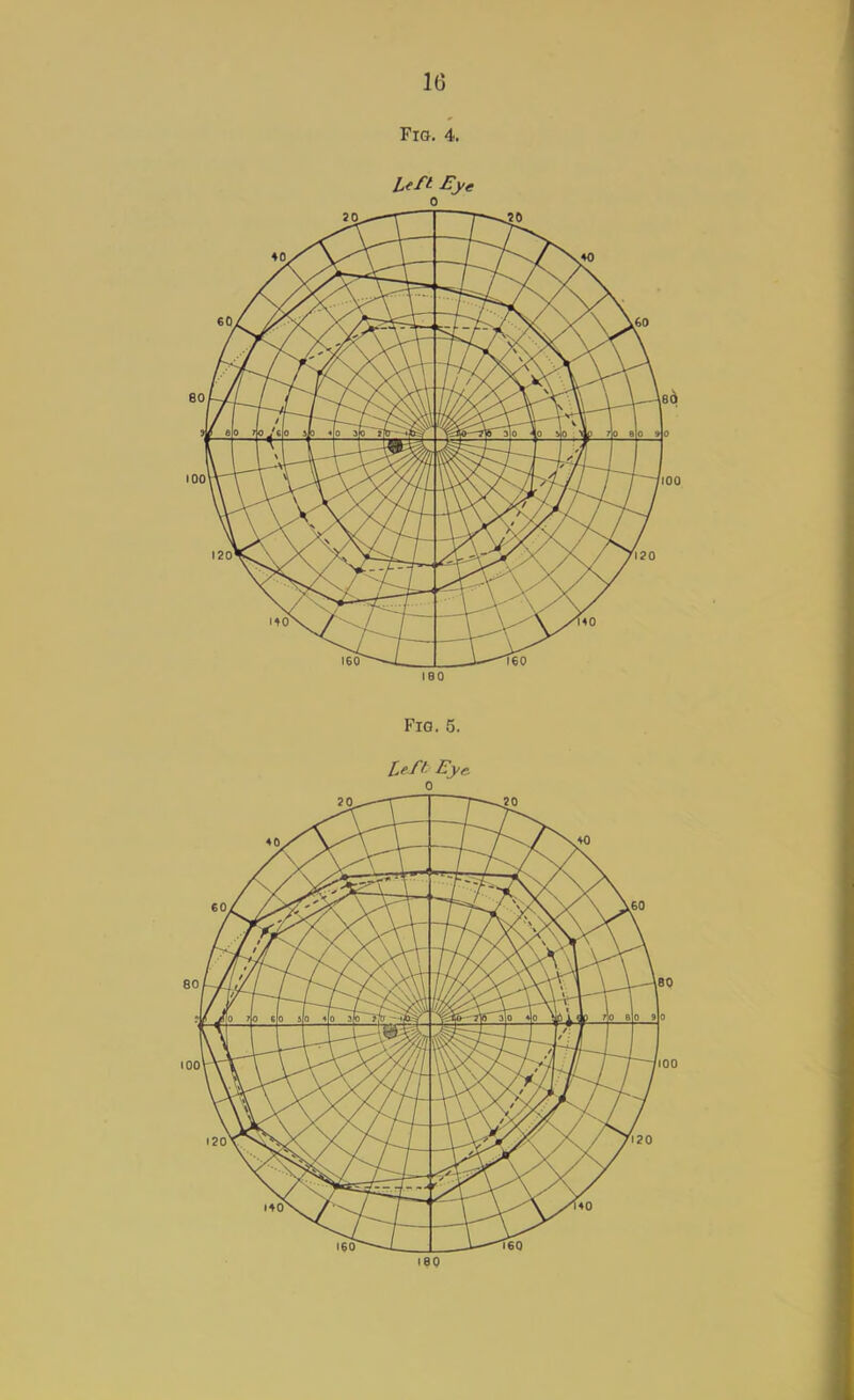 Fio. 4. 1 i I Lfft £ye 0 leo Fig. 5. left: Eye. 0 ISO