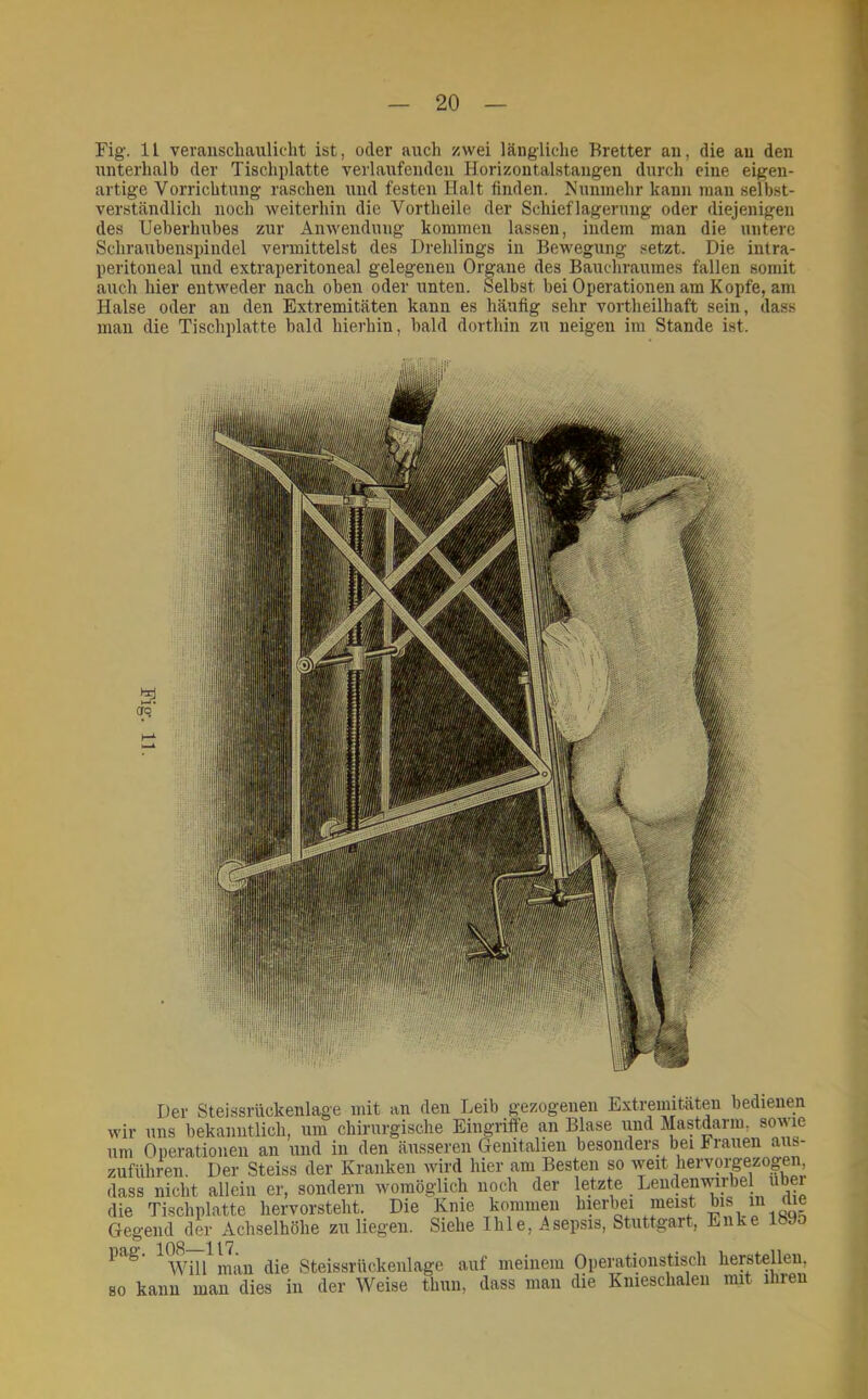 Fig. 11 veraiiscliaulicht ist, oder auch zwei längliche Bretter au, die au den unterhalb der Tischplatte verlaufenden Horizontalstangen durch eine eigen- artige Vorrichtung raschen und festen Halt finden. Munmehr kann man selb.st- verständlich noch weiterhin die Vortheile der Schieflagerung oder diejenigen des Ueberhubes zur Anwendung kommen lassen, indem man die untere Schraubenspindel vermittelst des Drehlings in Bewegung setzt. Die intra- peritoneal und extraperitoneal gelegenen Organe des Bauchraumes fallen somit auch hier entweder nach oben oder unten. Selbst bei Operationen am Kopfe, am Halse oder an den Extremitäten kann es häufig sehr vortheilhaft sein, dass man die Tischplatte bald hierhin, bald dorthin zu neigen im Stande ist. Der Steissrückenlage mit an den Leib gezogenen Extremitäten bedienen wir uns bekanntlich, um chirurgische Eingriffe an Blase iind Mastdarm, sowie um Operationen an und in den äusseren Genitalien besonders bei Frauen aus- zuflihren. Der Steiss der Kranken wird hier am Besten so weit hervorgezogen, dass nicht allein er, sondern womöglich noch der letzte Lendenwirbel über die Tischplatte hervorsteht. Die Knie kommen ^^erb^i meist bis in die Gegend der Achselhöhe zu liegen. Siehe Ihle, Asepsis, Stuttgart, Enke pag. Steissrückenlage auf meinem Operationstisch hersteilen, so kann man dies in der Weise thun, dass man die Knieschalen mit ihren