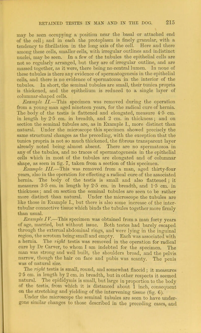 may be seen occupying a position near the basal or attached end of the cell; and in each the protoplasm is finely granular, with a tendency to fibrillation in the long axis of the cell. Here and there among these cells, smaller cells, with irregular outlines and indistinct nuclei, may be seen. In a few of the tubules the epithelial cells are not so regularly arranged, but they are of irregular outline, and are massed together, as it were, there being no central lumen. In none of these tubules is there any evidence of spermatogenesis in the epithelial cells, and there is no evidence of spermatozoa in the interior of the tubules. In short, the seminal tubules are small, their tunica propria is thickened, and the epithelium is reduced to a single layer of columnar-shaped cells. Example II.—This specimen was removed during the operation from a young man aged nineteen years, for the radical cure of hernia. The body of the testis is flattened and elongated, measure 4'5 cm. in length by 2‘5 cm. in breadth, and 2 cm. in thickness; and on section the seminal tubules are, as in Example I., more distinct than natural. Under the microscope this specimen showed precisely the same structural changes as the preceding, with the exception that the tunica propria is not so much thickened, the fibrous transparent layer already noted being almost absent. There are no spermatozoa in any of the tubules, and no traces of spermatogenesis in the epithelial cells which in most of the tubules are elongated and of columnar shape, as seen in fig. 7, taken from a section of this specimen. Example III.—This was removed from a man, aged thirty-four years, also in the operation for effecting a radical cure of the associated hernia. The body of the testis is small and also flattened; it measures 3'5 cm. in length by 2'5 cm. in breadth, and 1‘5 cm. in thickness; and on section the seminal tubules are seen to be rather more distinct than natural. Under the microscope the tubules are like those in Example I., but there is also some increase of the inter- tubular connective tissue which binds the tubules together more firmly than usual. Example IV.—This specimen was obtained from a man forty years of age, married, but without issue. Both testes had barely escaped through the external abdominal rings, and were lying in the inguinal region, the scrotum being small and empty. Each was associated with a hernia. The light testis was removed in the operation for radical cure by Dr Carver, to whom I am indebted for the specimen. The man was strong and well built, the shoulders broad, and the pelvis narrow, though the hair on face and pubis was scanty. The penis was of natural size. The right testis is small, round, and somewhat flaccid ; it measures 2'5 cm. in length by 2 cm. in breadth, but in other respects it seemed natural. The epididymis is small, butlai’ge in proportion to the body of the testis, from which it is distanced about 1 inch, consequent on the stretching and yielding of the intervening tissue (fig. 6). Under the microscope the seminal tubules are seen to have under- gone similar changes to those described in the preceding cases, aud