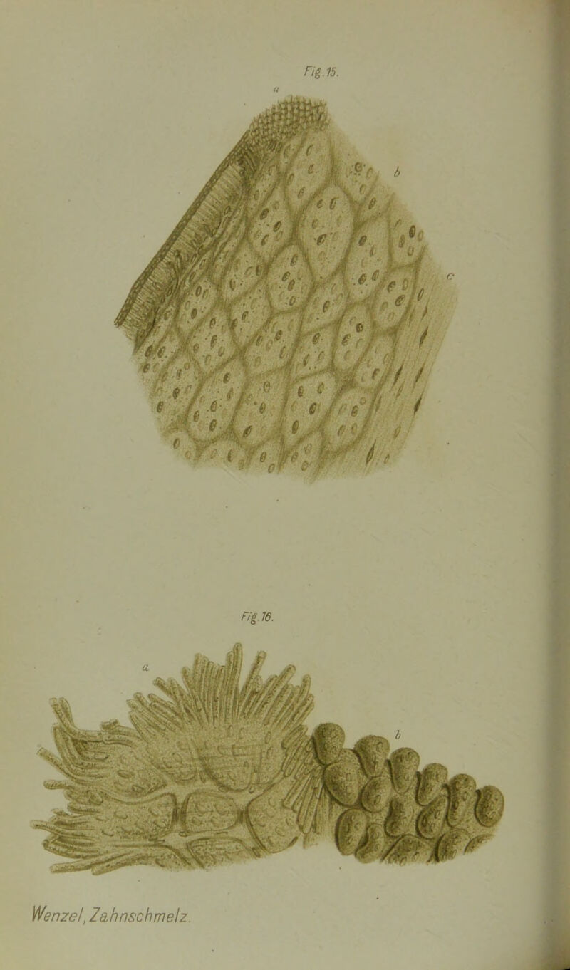 Wenzel, Zahnschmelz.