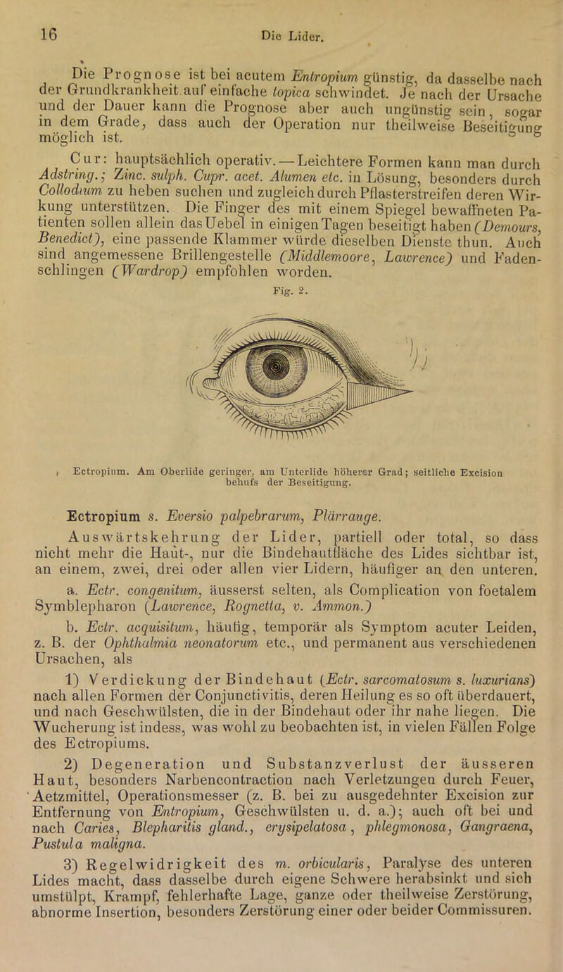 * j Prognose ist bei acutem Ewiroptum günstig, da dasselbe nach der Grrundkrankheit auf einfache to'pica schwindet. Je nach der Ursache und der Dauer kann die Prognose aber auch ungünstig sein sogar in d6m Gridclc^ däss auch dev Operation nur theilweise Beseitigung möglich ist. ° ° Cur: hauptsächlich operativ. — Leichtere Formen kann man durch Adstring. j Zinc. sulph. Cupr. acet. Alumen etc. in Lösung, besonders durch Collodnm zu heben suchen und zugleich durch Pflasterstreifen deren Wir- kung unterstützen. Die Finger des mit einem Spiegel bewaffneten Pa- tienten sollen allein dasUebel in einigen Tagen beseitigt haben (^Demours, Benedict), eine passende Klammer würde dieselben Drenste thun. Auch sind angemessene Brillengestelle (Middlemoore, Lawrence) und Faden- schlingen (Wardrop) empfohlen worden. Fig. 2. » Ectropium. Am Oberlide geringer, am Unterlide höherer Grad; seitliche Excision behufs der Beseitigung. Ectropium s. Eversio palpebrarum, Plärrauge. Auswärtskehrung der Lider, partiell oder total, so dass nicht mehr die Haiit-, nur die Bindehautfläche des Lides sichtbar ist, an einem, zwei, drei oder allen vier Lidern, häufiger an den unteren. a. Ectr. congenitum, äusserst selten, als Complication von foetalem Symblepharon {Lawrence, Rognetta, v. Ammon.) b. Ectr. acquisitum, häutig, temporär als Symptom acuter Leiden, z. B. der Ophthalmia neonatorum etc., und permanent aus verschiedenen Ursachen, als 1) Verdickung der Bindehaut {Ectr. sarcomatosum s. luxurians) nach allen Formen der Conjunctivitis, deren Heilung es so oft überdauert, und nach Geschwülsten, die in der Bindehaut oder ihr nahe liegen. Die Wucherung ist indess, was wohl zu beobachten ist, in vielen Fällen Folge des Ectropiums. 2) Degeneration und Substanzverlust der äusseren Haut, besonders Narbencontraction nach Verletzungen durch Feuer, ‘Aetzmittel, Operationsmesser (z. B. bei zu ausgedehnter Excision zur Entfernung von Entropium, Geschwülsten u. d. a.); auch oft bei und nach Caries, Blepharitis gland., erysipelatosa, phlegmonosa, Gangraena, Pustula maligna. 3) Regelwidrigkeit des m. orbicularis, Paralyse des unteren Lides macht, dass dasselbe durch eigene Schwere heräbsinkt und sich umstülpt, Krampf, fehlerhafte Lage, ganze oder theilweise Zerstörung, abnorme Insertion, besonders Zerstörung einer oder beider Commissuren.