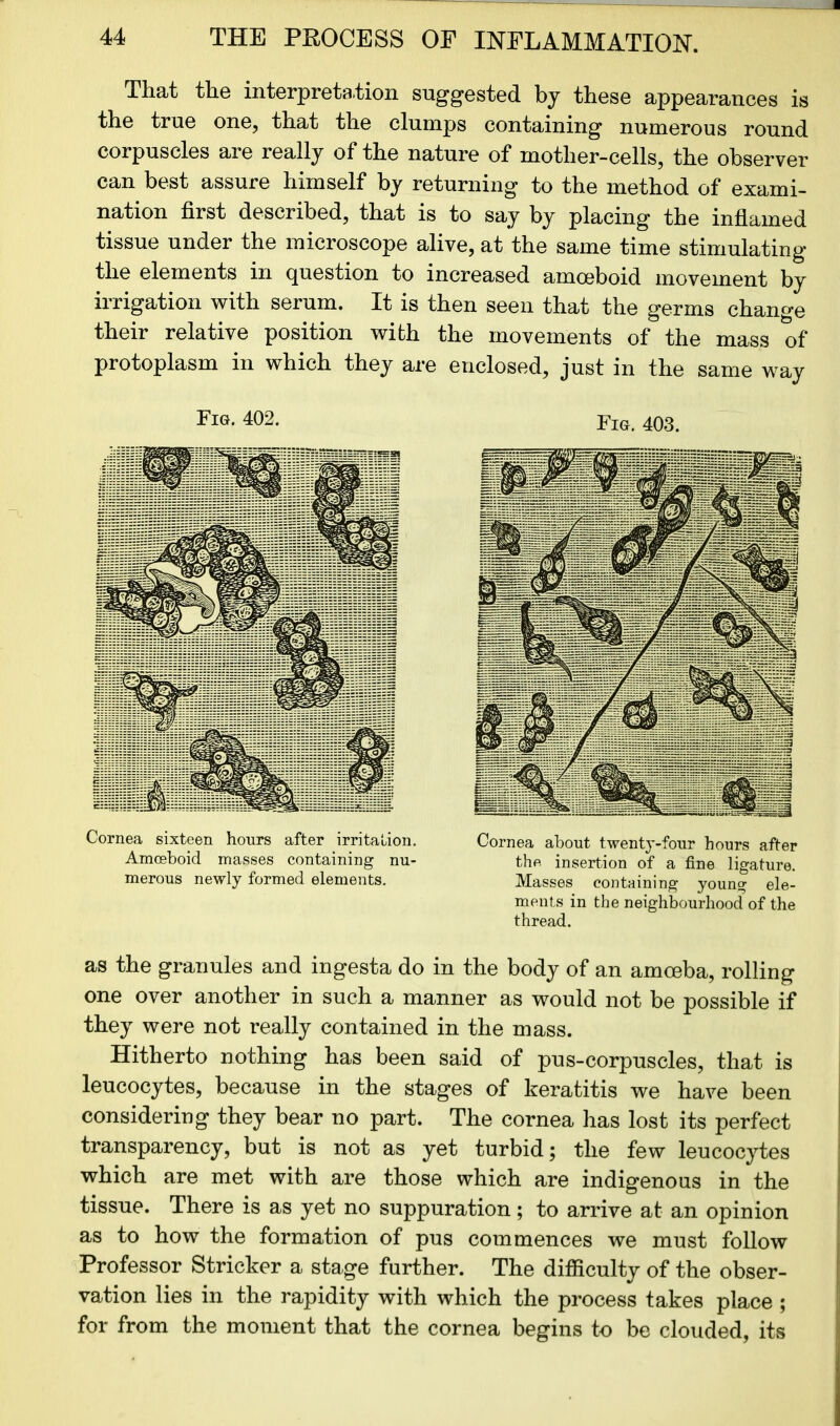 ■ 44 THE PROCESS OE INFLAMMATION, That the interpretation suggested by these appearances is the true one, that the clumps containing numerous round corpuscles are really of the nature of mother-cells, the observer can best assure himself by returning to the method of exami- nation first described, that is to say by placing the inflamed tissue under the microscope alive, at the same time stimulating the elements in question to increased amoeboid movement by irrigation with serum. It is then seen that the germs change their relative position with the movements of the mass of protoplasm in which they are enclosed, just in the same way Fig. 402. Fig. 403. as the granules and ingesta do in the body of an amoeba, rolling one over another in such a manner as would not be possible if they were not really contained in the mass. Hitherto nothing has been said of pus-corpuscles, that is leucocytes, because in the stages of keratitis we have been considering they bear no part. The cornea has lost its perfect transparency, but is not as yet turbid; the few leucocytes which are met with are those which are indigenous in the tissue. There is as yet no suppuration; to arrive at an opinion as to how the formation of pus commences we must follow Professor Strieker a stage further. The difficulty of the obser- vation lies in the rapidity with which the process takes place ; for from the moment that the cornea begins to be clouded, its Cornea sixteen hours after irritation, Amoeboid masses containing nu- merous newly formed elements. Cornea about twenty-four hours after the insertion of a fine ligature. Masses containing young ele- ments in the neighbourhood of the thread.