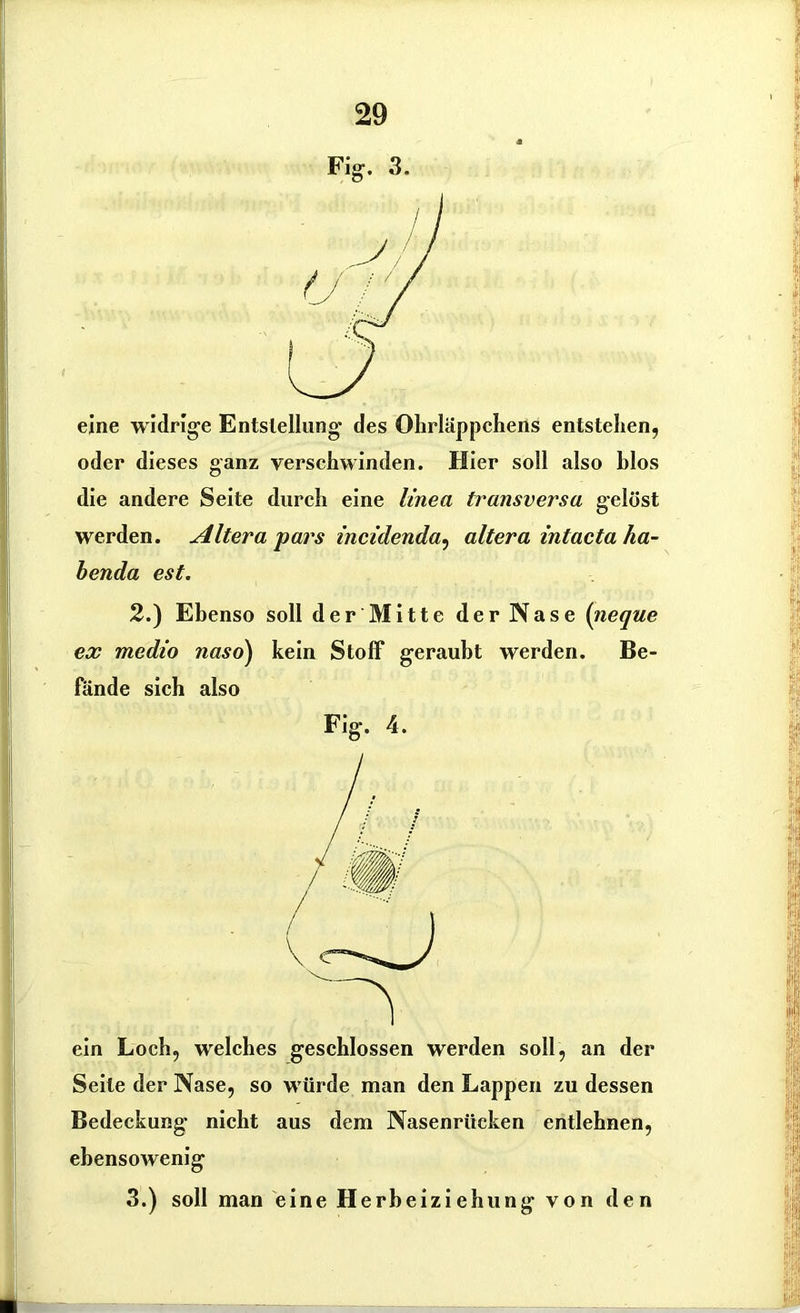 eine widrige Entstellung des Ohrläppchens entstehen, oder dieses ganz verschwinden. Hier soll also blos die andere Seite durch eine linea transversa gelöst werden. Altera pars incidenda, altera Intacta ha- benda est. 2.) Ebenso soll der Mitte der Nase (neque ex medio naso) kein Stoff geraubt werden. Be- fände sich also Fig. 4. ein Loch, welches geschlossen werden soll, an der Seite der Nase, so würde man den Lappen zu dessen Bedeckung nicht aus dem Nasenrücken entlehnen, ebensowenig 3.) soll man eine H erbeiziehung von den