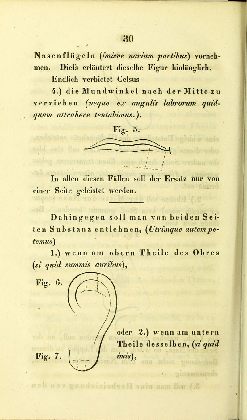 Nasenflügeln (imisve narium partibus) vorneh- men. Diefs erläutert dieselbe Figur hinlänglich. Endlich verbietet Celsus 4.) die Mundwinkel nach der Mitte zu verziehen (neque ex angnlis labrorum quid- quam attrahere tentabimus.). Fig. 5. In allen diesen Fällen soll der Ersatz nur von einer Seite geleistet werden. Dahingegen soll man von beiden Sei- ten Substanz entlehnen, (Utrimque antem pe- temus) 1.) wenn am obern Theile des Ohres (si quid summis auribus). I