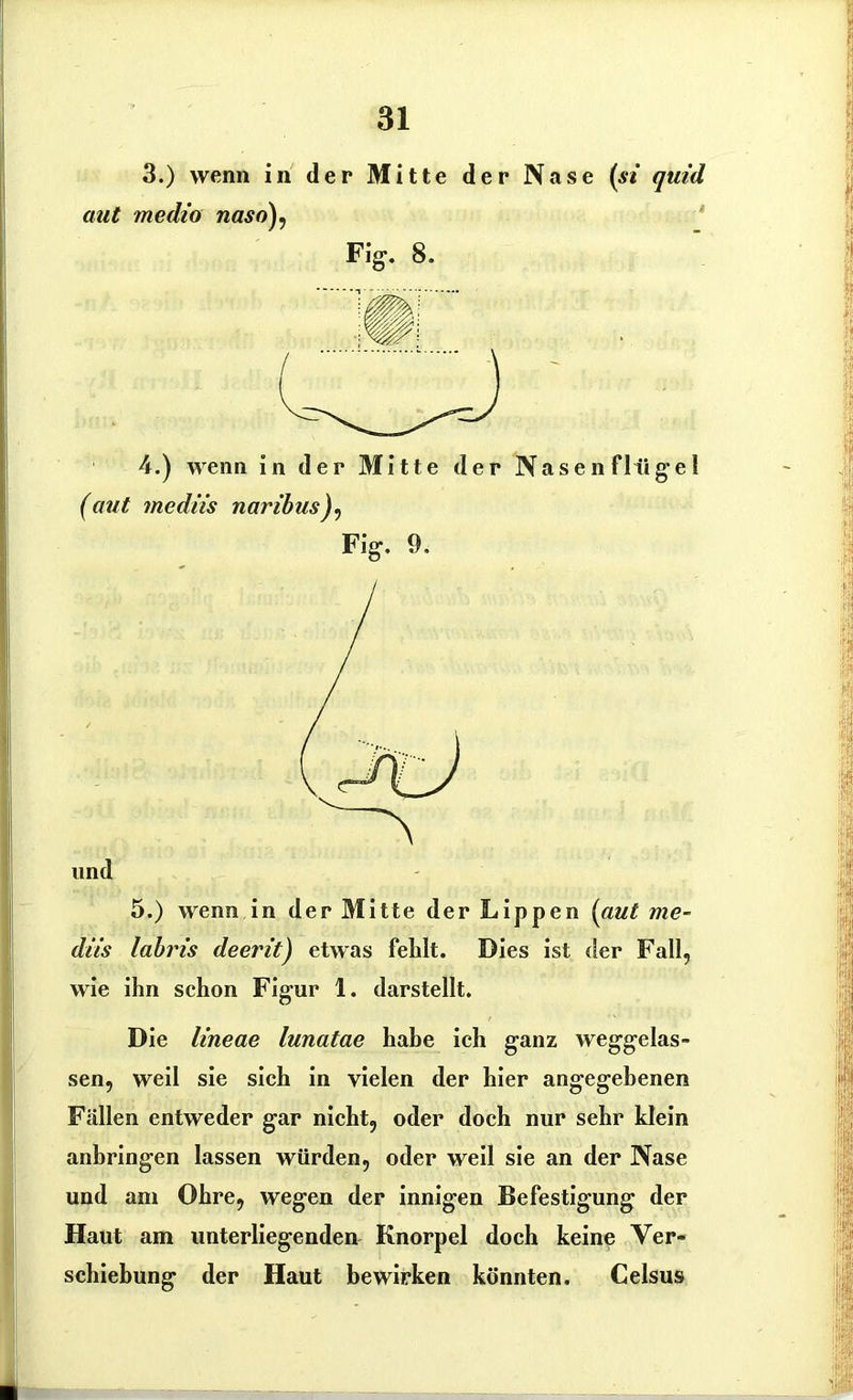 3.) wenn in der Mitte der Nase (si quid aut medio naso), Fig. 8. 4.) wenn in der Mitte der Nasenflügel (aut mediis naribusJ, Fig, 9, und 5.) wenn in der Mitte der Lippen (aut me- diis labris deerit) etwas fehlt. Dies ist der Fall, wie ihn schon Figur 1. darstellt. Die lineae lunatae habe ich ganz weggelas- sen, weil sie sich in vielen der hier angegebenen Fällen entweder gar nicht, oder doch nur sehr klein anbringen lassen würden, oder weil sie an der Nase und am Ohre, wegen der innigen Befestigung der Haut am unterliegenden Knorpel doch keine Ver- schiebung der Haut bewirken könnten. Celsus