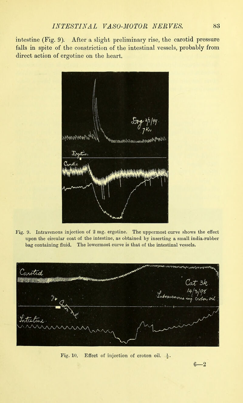 intestine (Fig. 9). After a slight preliminary rise, the carotid pressure falls in spite of the constriction of the intestinal vessels, probably from direct action of ergotine on the heart. Fig. 9. Intravenous injection of 2 mg. ergotine. The uppermost curve shows the effect upon the circular coat of the intestine, as obtained by inserting a small india-rubber bag containing fluid. The lowermost curve is that of the intestinal vessels. Fig. 10. Effect of injection of croton oil. 6—2