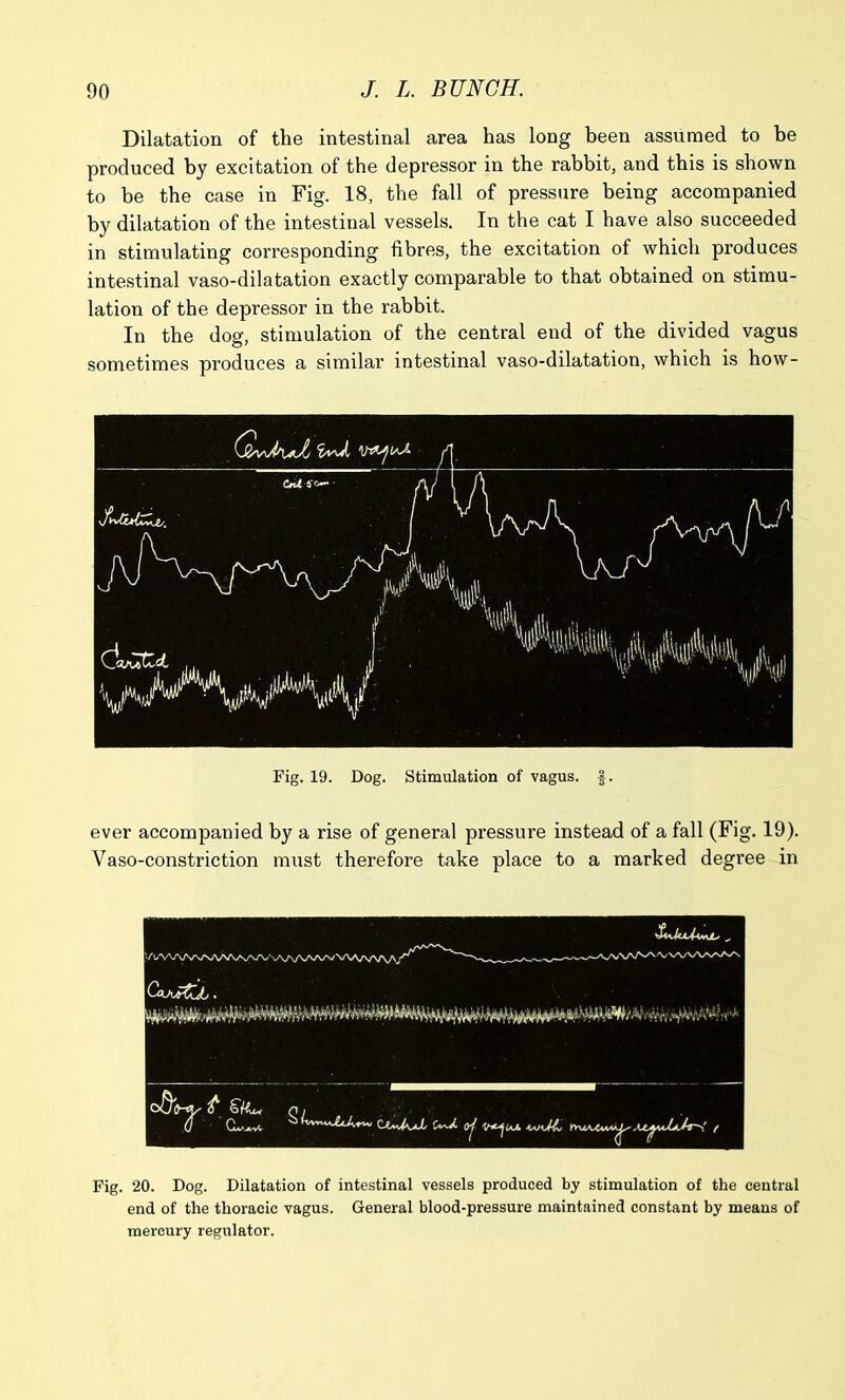 Dilatation of the intestinal area has long been assumed to be produced by excitation of the depressor in the rabbit, and this is shown to be the case in Fig. 18, the fall of pressure being accompanied by dilatation of the intestinal vessels. In the cat I have also succeeded in stimulating corresponding fibres, the excitation of which produces intestinal vaso-dilatation exactly comparable to that obtained on stimu- lation of the depressor in the rabbit. In the dog, stimulation of the central end of the divided vagus sometimes produces a similar intestinal vaso-dilatation, which is how- Fig. 19. Dog. Stimulation of vagus, f. ever accompanied by a rise of general pressure instead of a fall (Fig. 19). Vaso-constriction must therefore take place to a marked degree in ‘Yl#VV\A/\/SA/V\/V>f\AA/\A/VA/V\AA/V\/\A/J CoJxaZU, . ft (i j Fig. 20. Dog. Dilatation of intestinal vessels produced by stimulation of the central end of the thoracic vagus. General blood-pressure maintained constant by means of mercury regulator.