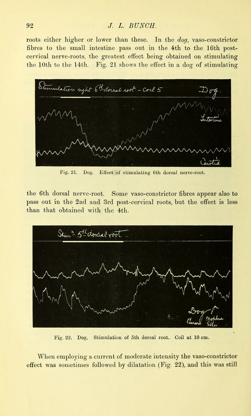 roots either higher or lower than these. In the dog, vaso-constrictor fibres to the small intestine pass out in the 4th to the 16th post- cervical nerve-roots, the greatest effect being obtained on stimulating the 10th to the 14th. Fig. 21 shows the effect in a dog of stimulating 'USj-IaJt () AJtrN~ -CjmI S a/VIA /]%v-. , , A N ! v V . /\ Sf -y—’/• V. \  l J A' vA... Jf\/vV\/v aAwaaaMvvv/^v'I L#S>-UN Fig. 21. Dog. Effect of stimulating 6th dorsal nerve-root. the 6th dorsal nerve-root. Some vaso-constrictor fibres appear also to pass out in the 2nd and 3rd post-cervical roots, but the effect is less than that obtained with the 4th. Fig. 22. Dog. Stimulation of 5th dorsal root. Coil at 10 cm. When employing a current of moderate intensity the vaso-constrictor effect was sometimes followed by dilatation (Fig. 22), and this was still