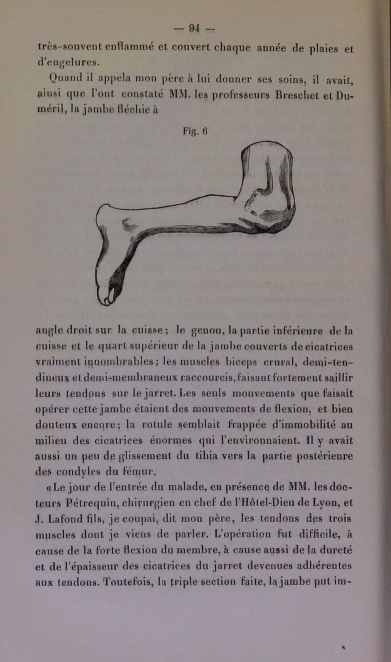 très-souvent enflammé et couvert chaque année de plaies et d’enfjel lires. (juand il appela mon père à lui donner ses soins, il avait, ainsi que l’ont constaté MM. les professeurs Breschet et Du- méril, la jambe fléchie à Fig. 6 aiqjle droit sur la cuisse; le {jenou, la partie inférieure delà cuisse et le quart siqiérieur de la jambe couverts de cicatrices vraiment iflnomhrahles ; les muscles biceps crural, demi-ten- dineux et demi-membraneux raccourcis, faisant fortement saillir leurs teudpus sur le jarret. Les seuls mouvements que faisait opérer cette jambe étaient des mouvements de flexion, et bien douteux encqre; la rotule semblait frappée d’immobilité au milieu des cicatrices énormes qui l’environnaient. 11 y avait aussi un peu de glissement du tibia vers la partie postérieure des condyles du fémur. «Le jour de l’entrée du malade, en présence de MM. les doc- teurs Pétrequin, chirurgien en chef de l’Hotel-Dieu de Lyon, et .1. Lafond fils, je coupai, dit mon père, les tendons des trois muscles dont je viens de parler. L’opération fut difficile, à cause de la forte flexion du membre, à cause aussi de la dureté et de l’épaisseur des cicatrices du jarret devenues adhérentes aux tendons. Toutefois, la triple section faite, Iq jambe put im- 4