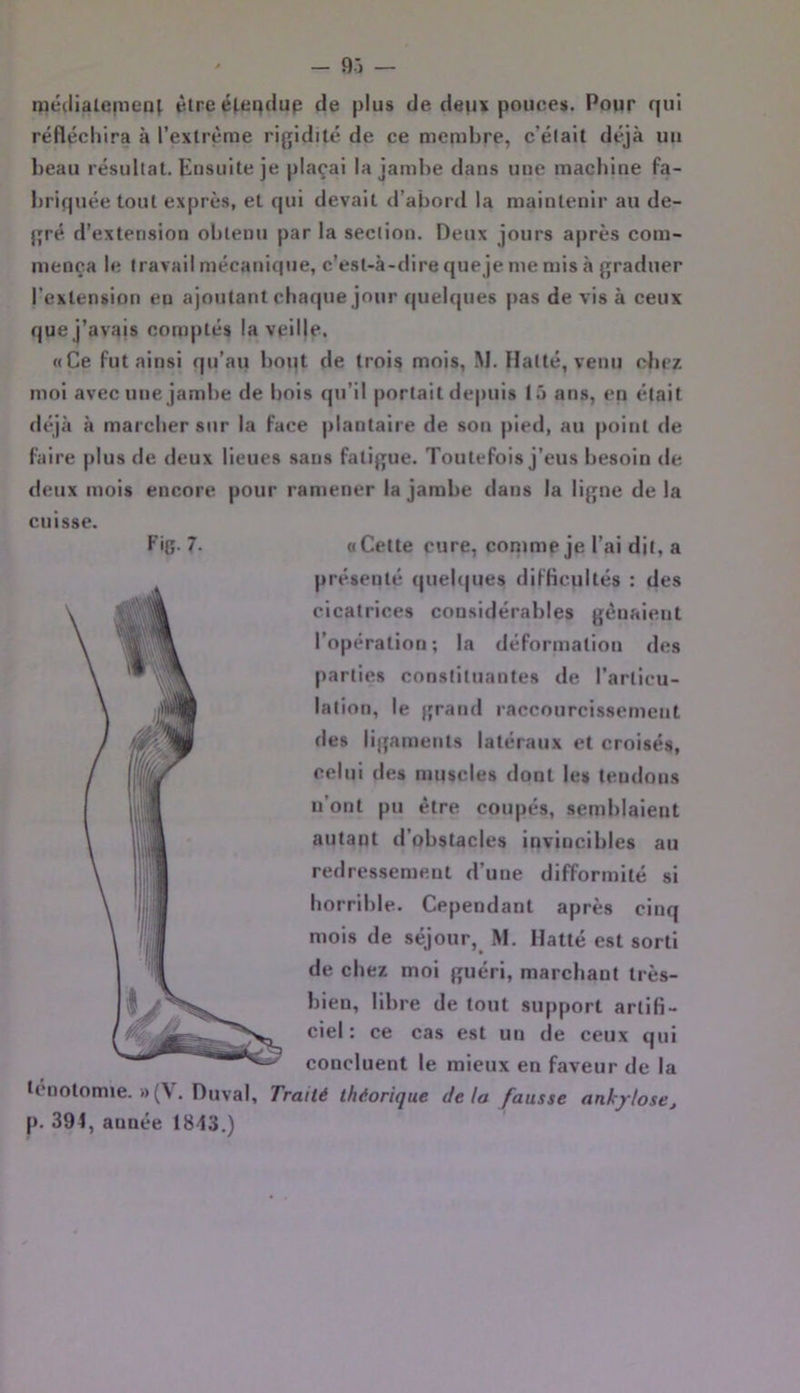 mé(lialerneQ( être é(.eqdup de plus de deiu pouces. Pour qui réfléchira à l’exlrème rigidité de ce membre, c’élait déjà im beau résultat. Ensuite je plaçai la jambe dans une machine fa- briquée tout exprès, et qui devait d’abord la maintenir au de- gré. d’extension obtenu par la section. Deux jours après com- mença le travail mécanique, c’est-à-dire queje me mis à graduer l’extension en ajoutant chaque jour quelques pas de vis à ceux quej’avajs comptés la vpil|e. «Ce Fut ainsi qu’au boqt de trois mois, M. Halte, venu chez moi avec une jambe de bois qu'il portait depuis 15 ans, en était déjà à marcher sur la Face plantaire de son pied, au point de faire plus de deux lieues sans fatigue. Toutefois j’eus besoin de deux mois encore pour ramener la jambe dans la ligne de la cuisse. Fig- 7. «Cette cure, comme je l’ai dit, a présenté quebjues difficultés : des cicatrices considérables gênaient l’opération; la déformation des parties constituantes de l’arlicu- lalion, le grand raccourcissement des ligaments latéraux et croisés, celui des muscles dont les tendons n’ont pu être coupés, semblaient autant d’obstacles invincibles au redressement d’une difformité si horrible. Cependant après cinq mois de séjour, M. llatté est sorti de chez moi guéri, marchant très- bien, libre de tout support artifi- ciel : ce cas est un de ceux qui concluent le mieux en faveur de la ténotomie. »{V. Duval, Traité théorique delà fausse ankylosé, p. 394, année 1843.)