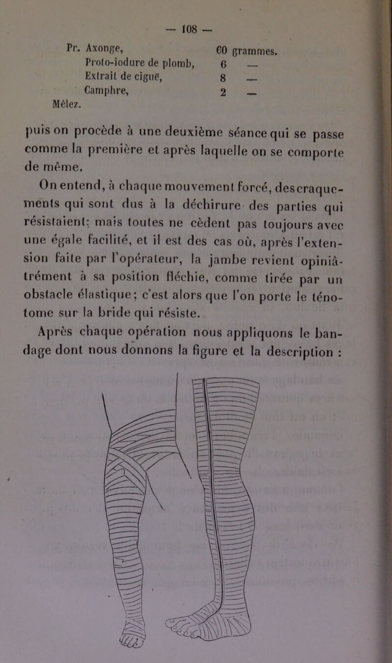 Pr. Axonge, Prolo-iodure de plomb, Extrait de ciguë, Camphre, Mêlez. puis on procède à une deuxième séance qui se passe comme la première et après laquelle on se comporte de mt*me. On entend, à chaque mouvement forcé, descraquc- ments qui sont dus a la dechirurC' des parties qui résistaient: mais toutes ne cèdent pas toujours avec une égale facilité, et il est des cas où, après l’exten- sion faite par l’opérateur, la jambe revient opiniâ- trément à sa position fléchie, comme tirée par un obstacle élastique; c’est alors que l’on porte le téno- tome sur la bride qui résiste. Après chaque opération nous appliquons le ban- dage dont nous donnons la figure et la description : GO grammes. 6 — 8 — 2 — I . i