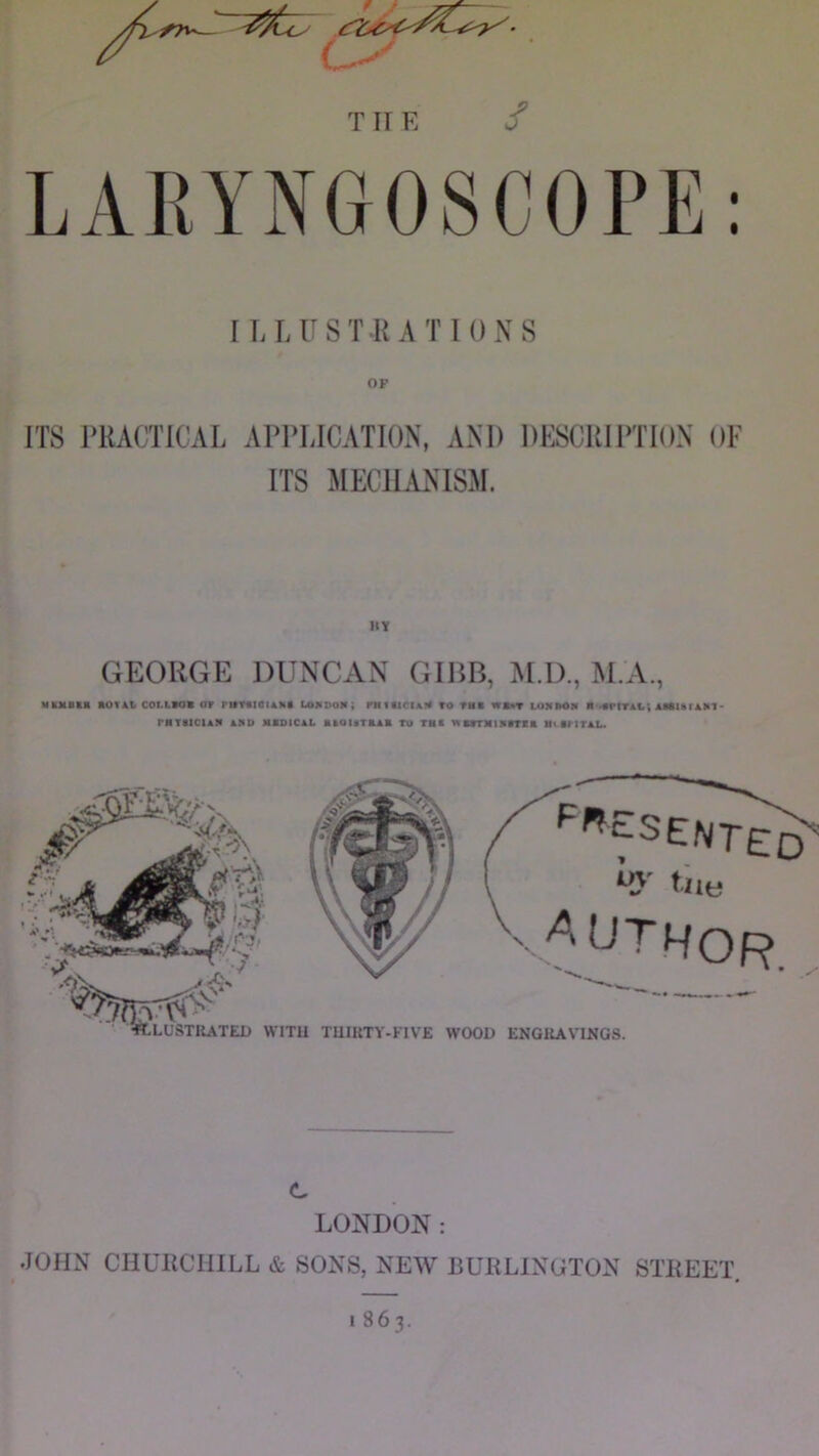 THE / I LLUSTRATIONS OF ITS 1‘RACTICAL APPLICATION, AND DESCRIPTION OF ITS MECHANISM. GEORGE DUNCAN GIHB, M.D., M.A., MttMStK aOTAt C0I.L*0« 07 r»T«IOIAllt LOJVDOM; PMttlCIAI* TO TMC W*»T lOMaOM ■ *«rtTAI.i AJOIsrikllT' r«TaicuN AHD msoical atouTAAB TO TBt iWBrrataarta atanrAL. c LONDON: JOHN CHURCHILL & SONS, NEW BURLINGTON STREET. 1 863.