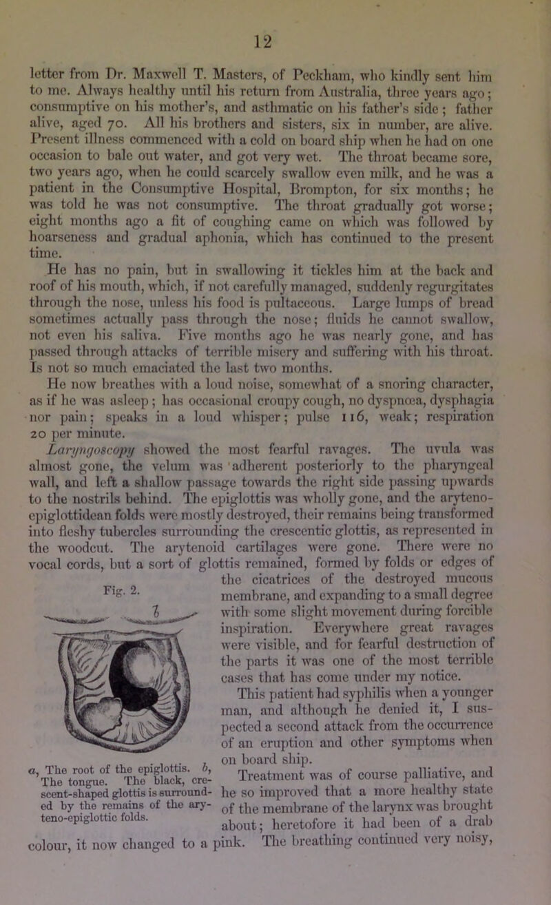 letter from Dr. Maxwell T. Masters, of Peckliam, who kindly sent him to me. Always healthy until his return from Australia, three years ago; consumptive on his mother’s, and a.sthmatic on his father’s side ; father alive, aged 70. All his brothers and sisters, six in number, are alive. Present illness commenced with a cold on board ship when he had on one occasion to bale out water, and got very wet. The throat became sore, two years ago, when he could scarcely swallow even milk, and he was a patient in the Consumptive Hospital, Brompton, for six months; he was told he was not consumptive. The throat gradually got worse; eight months ago a fit of coughing came on which was followed by hoarseness and gradual aphonia, which has continued to the present time. He has no pain, hut in swallowing it tickles him at the back and roof of his mouth, which, if not carefully managed, suddenly regurgitates through the nose, uidess his food is pultaceous. Large lumps of bread sometimes actually pass through the nose; fluids he cannot swallow, not even his saliva. Five months ago he was nearly gone, and has j)asscd through attacks of terrible misery and suffering with his throat. Is not so much emaciated the last two months. He now breathes with a loud noise, somewhat of a snoring character, as if he was asleep ; has occasional croupy cough, no dyspnoea, dysphagia nor pain; speaks in a loud whisj)er; jndsc 116, weak; respiration 20 per minute. Lariptgoscopn shoAved the most fearful ravages. Tlie uvtda was almost gone, the velum was adherent posteriorly to the phar}Tigcal Avail, and left a shalloAv passage toAvards the right side ])assing upAvards to the nostrils behind. The epiglottis aa'us Avholly gone, and the aryteno- cpiglottidean folds were mostly de.stroyed, their remains being trausfonned into fleshy tubercles surrounding the eresccntic glottis, as represented in the AA’oodcut. The arytenoid cartilages AA'cre gone. Tliere Avere no vocal cords, but a sort of glottis remained, formed by folds or edges of the cicatrices of the destroyed mueous membrane, and expanding to a small degree AAuth some slight movement during forcible inspiration. EveryAvhere great ravages Avere visible, and for fearful destruction of the parts it AA'as one of the most terrible cases that has come under my notice. Tdiis patient had syphilis AA'hen a younger man, and although he denied it, 1 sus- pected a second attack from the occuiTcnce of an eruption and other symptoms Avhen on board ship. Treatment Avas of course palliative, and he so improved that a more healthy state of the membrane of the larynx Avas brought about; heretofore it had been of a drab colour, it now changed to a pink. Tdie breathing continued very noisy. Tig. 2. o. The root of the epiglottis. 6, The tongue. The black, cre- scent-shaped glottis is surround- ed by the remains of tho ary- teno-epiglottic folds.