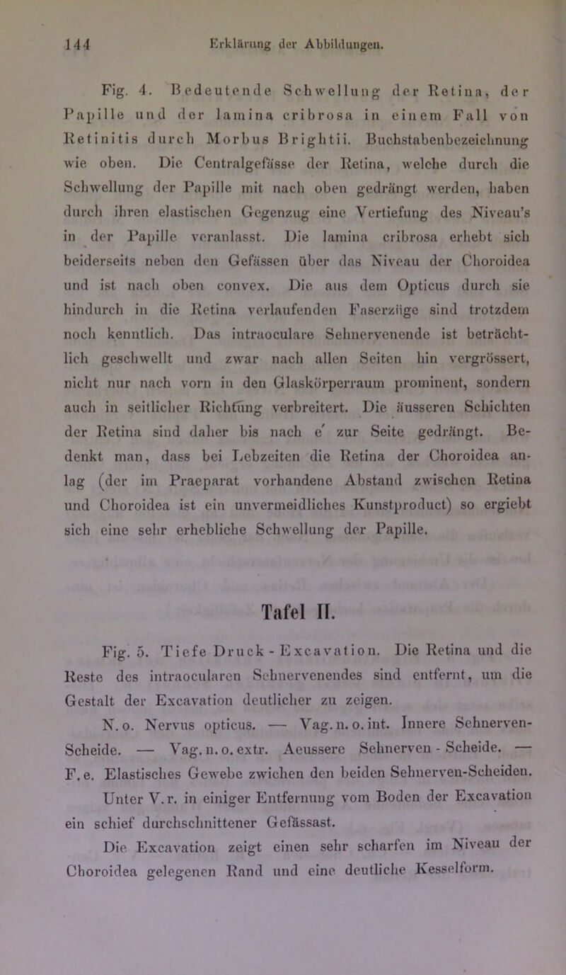 Fig. 4. Bedeutende Schwellung der Retina, der Papille und der lainina cribrosa in einem Fall von Retinitis durch Morbus Brightii. Buchstabenbezeichnung wie, oben. Die Centralgefasse der Retina, welche durch die Schwellung der Papille mit nach oben gedrängt werden, haben durch ihren elastischen Gegenzug eine. Vertiefung des Niveau’s in der Papille veranlasst. Die lamina cribrosa erhebt sich beiderseits neben den Gefässen über das Niveau der Choroidea und ist nach oben convex. Die aus dem Opticus durch sie hindurch in die Retina verlaufenden Faserziigc sind trotzdem noch kenntlich. Das intraoculare Sehuervcnende ist beträcht- lich geschwellt und zwar nach allen Seiten hin vergrössert, nicht nur nach vorn in den Glaskürperraum prominent, sondern auch in seitlicher Richtung verbreitert. Die äusseren Schichten der Retina sind daher bis nach c zur Seite gedrängt. Be- denkt man, dass bei Lebzeiten die Retina der Choroidea an- lag (der im Praeparat vorhandene Abstand zwischen Retina und Choroidea ist ein unvermeidliches Kunstproduct) so ergiebt sich eine sehr erhebliche Schwellung der Papille. Tafel II. Fig. 5. Tiefe Druck - Excavation. Die Retina und die Reste des intraoeularen Sehnervenendes sind entfernt, um die Gestalt der Excavation deutlicher zu zeigen. N. 0. Nervus opticus. — Vag. n. o. int. Innere Schnerven- Scheide. — Vag. n. o. extr. Aeussere Sehnerven - Scheide. — F.e. Elastisches Gewebe zwichen den beiden Sehnerven-Scheiden. Unter V.r. in einiger Entfernung vom Boden der Excavation ein schief durchschnittener Gefössast. Die Excavation zeigt einen sehr scharfen im Niveau der Choroidea gelegenen Rand und eine deutliche Kesselform.