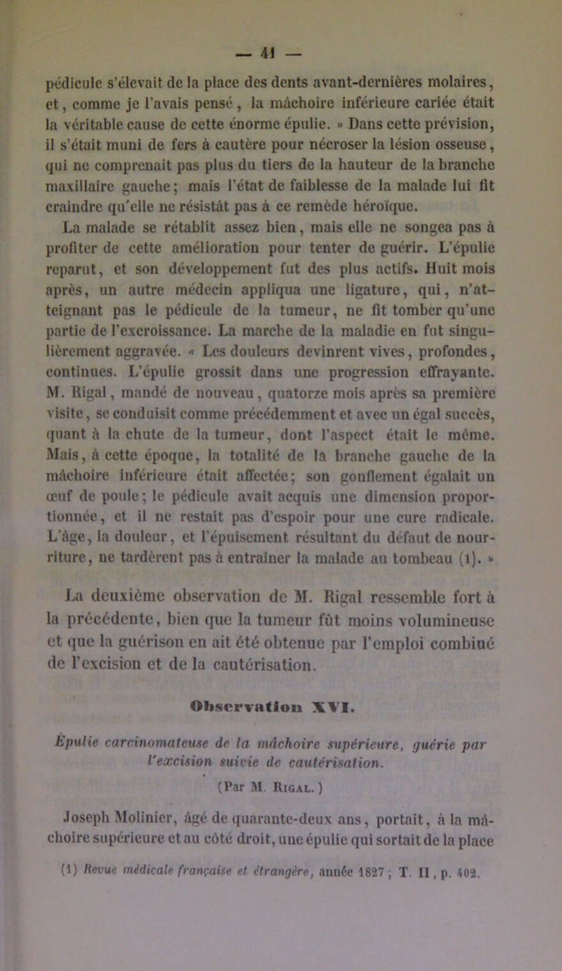 — Ai pédicule s’élevait de la place des dents avant-dernières molaires, et, comme je l’avais pensé , la mâchoire inférieure cariée était la véritable cause de cette énorme épulie. « Dans cette prévision, il s’était muni de fers à cautère pour nécroser la lésion osseuse, qui ne comprenait pas plus du tiers de la hauteur de la branche maxillaire gauche ; mais l’état de faiblesse de la malade lui fît craindre qu'elle ne résistât pas à ce remède héroïque. La malade se rétablit assez bien, mais elle ne songea pas à profiter de cette amélioration pour tenter de guérir. L’épulie reparut, et son développement fut des plus actifs. Huit mois après, un autre médecin appliqua une ligature, qui, n’at- teignant pas le pédicule de la tumeur, ne fît tomber qu’une partie de l’excroissance. La marche de la maladie en fut singu- lièrement aggravée. « Les douleurs devinrent vives, profondes, continues. L’épulle grossit dans une progression effrayante. M. Rigal, mandé de nouveau, quatorze mois après sa première visite, se conduisit comme précédemment et avec un égal succès, quant à la chute de la tumeur, dont l’aspect était le même. Mais, à cette époque, la totalité de la branche gauche de la mâchoire inférieure était affectée; son gonflement égalait un œuf de poule; le pédicule avait acquis une dimension propor- tionnée, et il ne restait pas d’espoir pour une cure radicale. L’âge, la douleur, et l’épuisement résultant du défaut de nour- riture, ne tardèrent pas à entraîner la malade au tombeau (l). » La deuxième observation de M. Rigal ressemble fort à la précédente, bien que la tumeur fût moins volumineuse et que la guérison en ait été obtenue par l’emploi combiné de l’excision et de la cautérisation. 01i.serva(lou XVI. Épulie carcinomateuse de la mâchoire supérieure, guérie par l'excision suivie de cautérisation. (Par M. Rigal. ) .loseph Molinier, âgé de quarante-deux ans, portait, à la mâ- choire supérieure et au côté droit, une épulie qui sortait de la place.