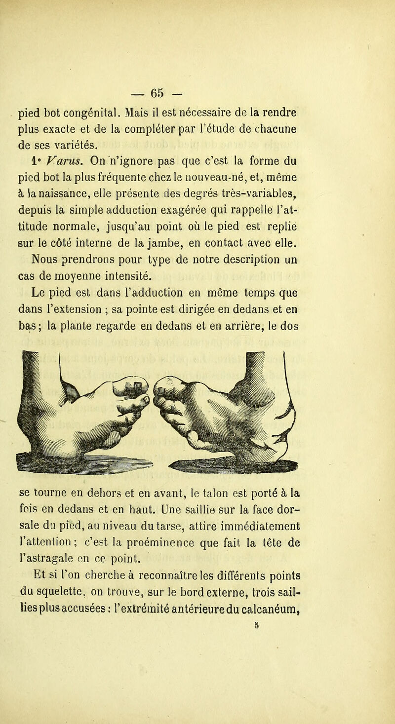 pied bot congénital. Mais il est nécessaire de la rendre plus exacte et de la compléter par l’étude de chacune de ses variétés. I9 Varus. On n’ignore pas que c’est la forme du pied bot la plus fréquente chez le nouveau-né, et, même à la naissance, elle présente des degrés très-variables, depuis la simple adduction exagérée qui rappelle l’at- titude normale, jusqu’au point où le pied est replie sur le côté interne de la jambe, en contact avec elle. Nous prendrons pour type de notre description un cas de moyenne intensité. Le pied est dans l’adduction en même temps que dans l’extension ; sa pointe est dirigée en dedans et en bas ; la plante regarde en dedans et en arrière, le dos se tourne en dehors et en avant, le talon est porté à la fois en dedans et en haut. Une saillie sur la face dor- sale du pied, au niveau du tarse, attire immédiatement l’attention ; c’est la proéminence que fait la tête de l’astragale en ce point. Et si l’on cherche à reconnaître les différents points du squelette, on trouve, sur le bord externe, trois sail- lies plus accusées : l’extrémité antérieuredu calcanéum, s