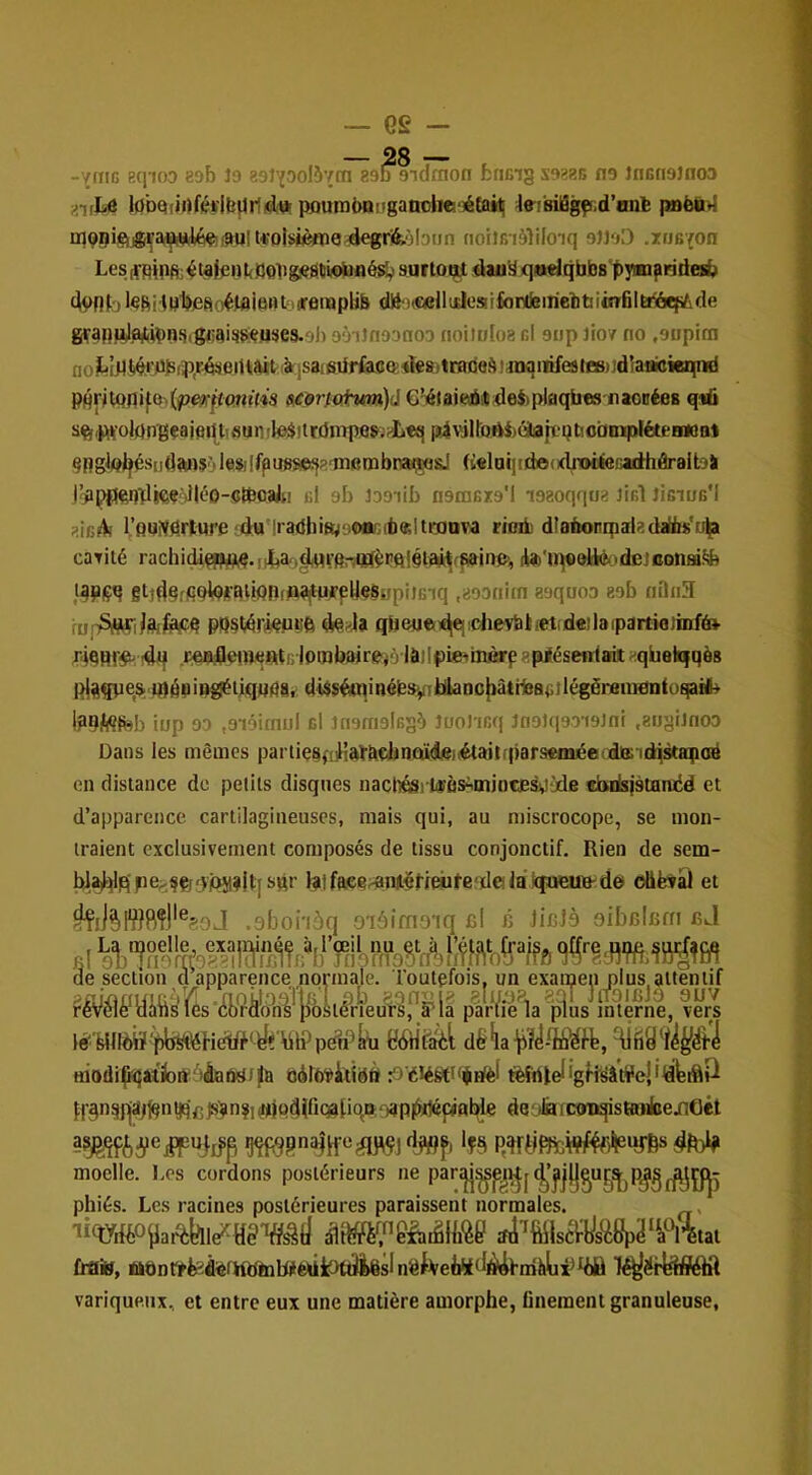 — Gg - -vniG Bqioo 89b îo 89J'pol57m 89l) 9idmon fcricig s9ï8b ne Jnetieinos ■i^lhâ lobqiirtfétjbflrîicl» poumt>oi'ganoli«oé£aiii| JeiisilSgpd’onfe p»èUM ui05ieij8ra^l^(9Ult«o|si(^e4egr&M9 noilBiàliloiq eWel) .xuB'{on Lesifptb^]^t^l^ut<Solig.«stiK)b!né^ surto^ dau^ qio«lqbb8 by>Bifindc9& dvfjfol«bilMl>,e8oéiflimH‘>ireiiaplib dB uceUudosifortfeiriebtiiOTfilÈrâqitde gfanuJï^^Vijfi.g<iai!i»çuses.9h goiJneanoe noiloba gI 9up Jlov no ,9opicn nojE^bl4^.rb)S(p,r.é!ieiltaâtiàrisaisdrfoSQ'4teS)traDeS)iiKiiiifeâleB),idîanioie^ PprjlQ^i^o^(f)e!)f^(Wi!■(^5 G'iélaitsditdefcpIflqfaes iiaoBées q%û sft|)rtiolfln'gçaipqtisunrli9à!tt(}nTpesiJ'L«q piviltoAiéitojïpticbBïpléteHioot §Pg^Al^!^iid;b)$‘>l@$iIfpu8S&88'niembna^sJ Gdai][de<i(lroèiieGadhérait9a Jîppp^ïlkç'JK’O-Steoaiti g1 9b l99iib neniGxa'l laaoqqua jîgI Jîgiug'1 rQUiygrtufe‘da’|ra(ihiaj‘.iC)OG(t«I tmova rioilu dtadonipaladadis'u^ caTité iUb'iq«0l!lé<,'de]oonmSb l^piçq gtJd§r^;q^(QjrQlip^f^^^lj^pfelleSi(pilG^q ,899«itn aequoD eeb nQ«3 fu^S|SM^l^3f^^b pp§l,^rkuiife qbeuen^ei chevbhetideîlaipartiejnifé» r4gBr$^ 4q loinbairevrlàiIpieiO^ apiéseidait qbelqqès l^açpes».q)é»ii»gèiiqHflat dUséminéfeS'^iJallancfiàtüeaGilégéranMnjiüÊjaife iup 09 ,9i9imul cl ineraelGS^ îuoJ icq JneJqeaisJnl .atjgiJnoo Dans les mêmes pariieaqiHat&djnQïdjeiiétailîparseiiiéetdia; id^staopoé en distance de petits disques nachéï)1«às^inioteâ),ijd8 ebdsiàlanbd et d’apparence cartilagineuses, mais qui, au miscrocope, se mon- traient exclusivement composés de tissu conjonctif. Rien de sem- blsd)Iqpe;;?Ç;'Vi(>M?lt[Sdr latffteenanit^fieùfe'dela kjueuB-de oliëvàl et .abohàq oiâifno'iq cl c licià oibclcfri cJ cl fi! O, ,— . de section d apparence normale. 1 outçfois fèV^é*yilfi^ ïés‘(^briiàn'è^iibstér^e^^^ fflodi(k}atfcn‘iàaiW)^a odrwidiëtt ^>éléPtfi|rièf fèfrtlel'gfi'^tVeî'lêibiSU î(’§n5qajlgnyqcp5in?iiiiiiod|fi(^[iqiï/)ap|^p)nbî« de jlâfCOiiqistaiibeilOêt moelle. Los cordons postérieurs ne pan|j^p^i^j^’ji|(j^ug!^p^g^y:|- phiés. Les racines postérieures paraissent normales. , 'laWilai^fel^Hg'îffâd îîlt^‘.&ênâlli<èe îfJi'^ftilsci^lis'è8p2‘mtal frai», ttbnttted^èfWdtaWédiPftJiêslnb^Veta^lÀibnâhliÿ^ilà T^ërfeSâfl variqueux, et entre eux une matière amorphe, finement granuleuse,