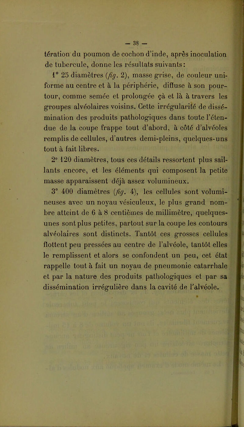 tération du poumon de cochon d’inde, après inoculation de tubercule, donne les résultats suivants : 1“ 25 diamètres {jig. 2), masse grise, de couleur uni- forme au centre et à la périphérie, difiuse à son pour- tour, comme semée et prolong-ée çà et là à travers les g’roupes alvéolaires voisins. Cette irrég’ularité de dissé- mination des produits patholog-iques dans toute l’éten- due de la coupe frappe tout d’abord, à côté d’alvéoles remplis de cellules, d’autres demi-pleins, quelques-uns tout à fait libres. 2® 120 diamètres, tous ces détails ressortent plus sail- lants encore, et les éléments qui composent la petite masse apparaissent déjà assez volumineux. 3° 400 diamètres {jig. 4), les cellules sont volumi- neuses avec un noyau vésiculeux, le plus g’rand nom- bre atteint de 6 à 8 centièmes de millimètre, quelques- unes sont plus petites, partout sur la coupe les contours alvéolaires sont distincts. Tantôt ces g'rosses cellules flottent peu pressées au centre de l’alvéole, tantôt elles le remplissent et alors se confondent un peu, cet état rappelle tout à fait un noyau de pneumonie catarrhale et par la nature des produits patbolog-iques et par sa dissémination irrégulière dans la cavité de Talvéole.