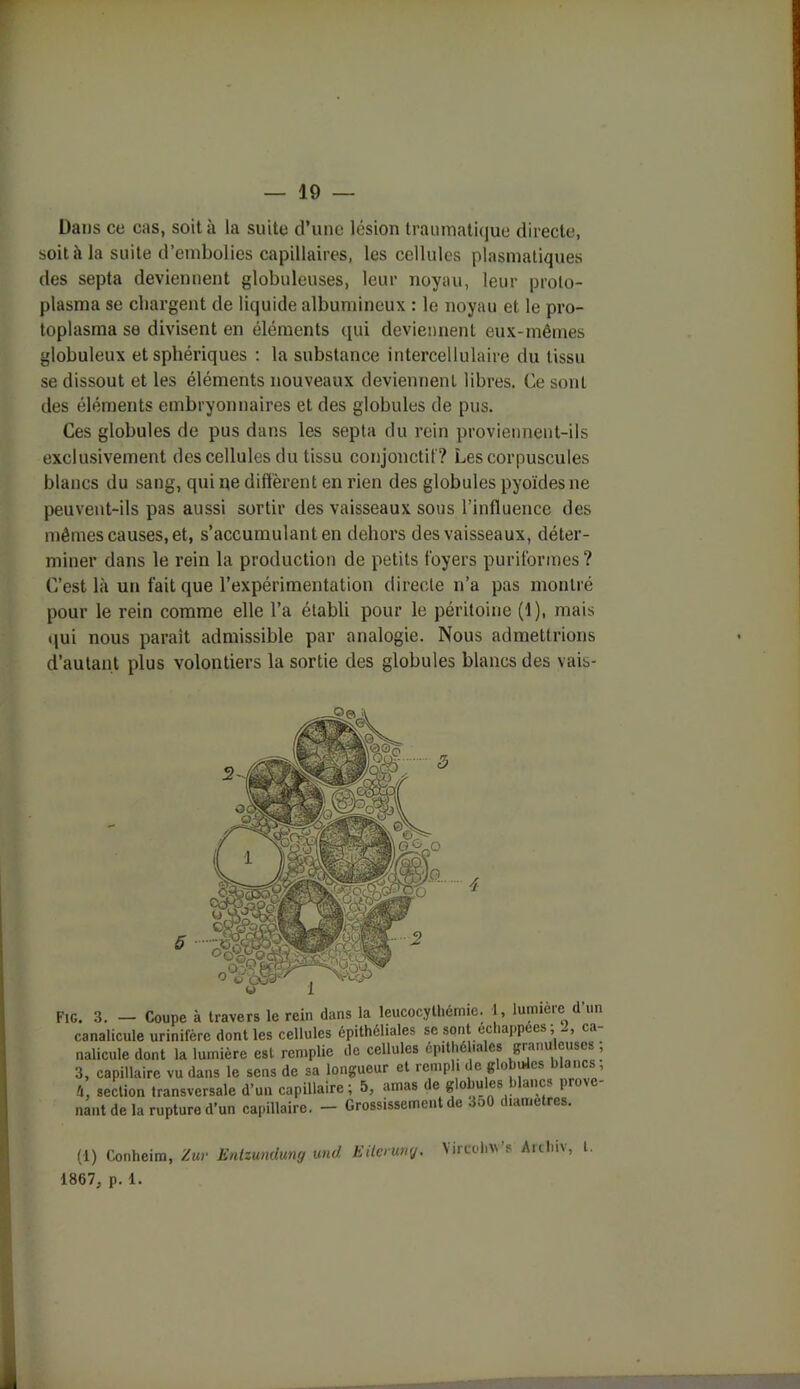 Dans ce cas, soit à la suite d’une lésion traumatique directe, soit à la suite d’embolies capillaires, les cellules plasmatiques des septa deviennent globuleuses, leur noyau, leur proto- plasma se chargent de liquide albumineux : le noyau et le pro- toplasma se divisent en éléments qui deviennent eux-mêmes globuleux et sphériques : la substance intercellulaire du tissu se dissout et les éléments nouveaux deviennent libres. Ce sont des éléments embryonnaires et des globules de pus. Ces globules de pus dans les septa du rein proviennent-ils exclusivement des cellules du tissu conjonctif? Les corpuscules blancs du sang, qui ne diffèrent en rien des globules pyoïdes ne peuvent-ils pas aussi sortir des vaisseaux sons l’influence des mêmes causes, et, s’accumulant en dehors des vaisseaux, déter- miner dans le rein la production de petits foyers puriformes? C’est là un fait que l’expérimentation directe n’a pas montré pour le rein comme elle l’a établi pour le péritoine (1), mais qui nous paraît admissible par analogie. Nous admettrions d’autant plus volontiers la sortie des globules blancs des vais- u x « 1- i .1 lnmiAt'P H’nn 5 4 (1) Conheim, Zur Entzundung und. EUci uny. 1867, p. 1. Vircolnv’s Arcliiv, t.