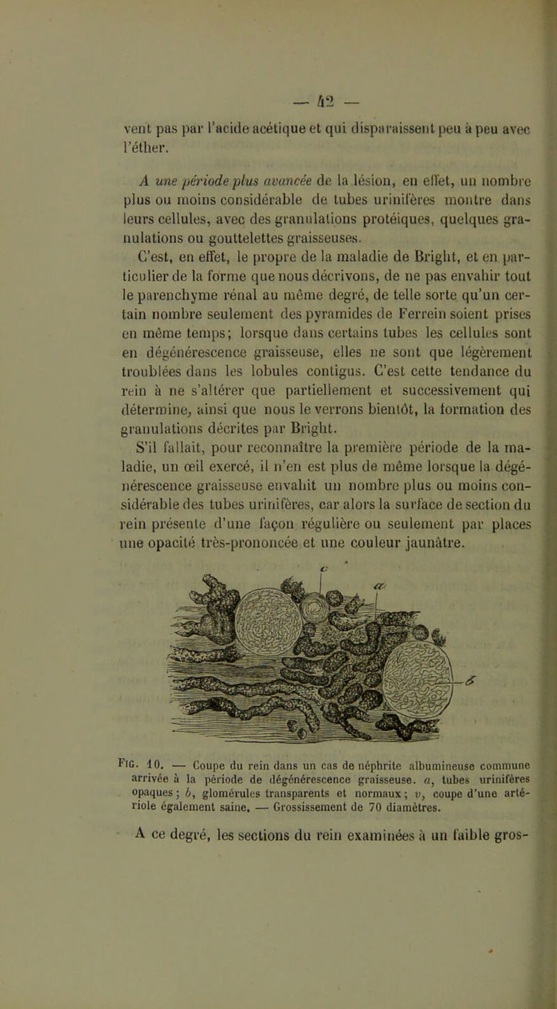 vent pas par l’acide acétique et qui disparaissent peu à peu avec l’éther. A une période plus avancée de la lésion, en effet, un nombre plus ou moins considérable de tubes urinifères montre dans leurs cellules, avec des granulations protéiques, quelques gra- nulations ou gouttelettes graisseuses. C’est, en effet, le propre de la maladie de Bright, et en par- ticulier de la forme que nous décrivons, de ne pas envahir tout le parenchyme rénal au même degré, de telle sorte qu’un cer- tain nombre seulement des pyramides de Ferrein soient prises en même temps; lorsque dans certains tubes les cellules sont en dégénérescence graisseuse, elles ne sont que légèrement troublées dans les lobules contigus. C’est cette tendance du rein à ne s’altérer que partiellement et successivement qui détermine, ainsi que nous le verrons bientôt, la formation des granulations décrites par Bright. S’il fallait, pour reconnaître la première période de la ma- ladie, un œil exercé, il n’en est plus de même lorsque la dégé- nérescence graisseuse envahit un nombre plus ou moins con- sidérable des tubes urinifères, car alors la surface de section du rein présente d’une façon régulière ou seulement par places une opacité très-prononcée et une couleur jaunâtre. Fig. 10. — Coupe du rein dans un cas de néphrite albumineuse commune arrivée à la période de dégénérescence graisseuse, a, tubes urinifères opaques ; ô, glomérules transparents et normaux ; v, coupe d’une arté- riole également saine. — Grossissement de 70 diamètres. A ce degré, les sections du rein examinées à un faible gros-