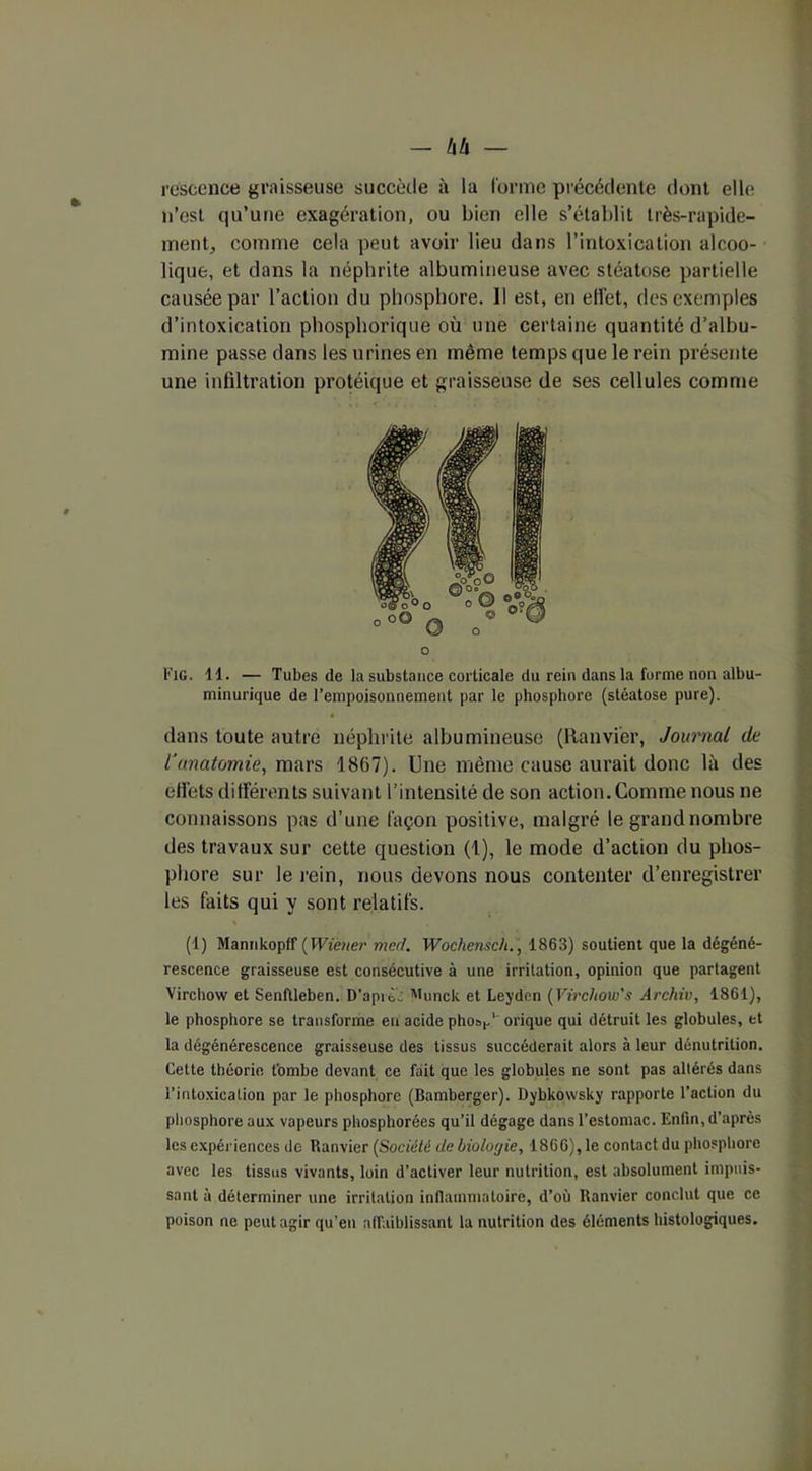 — L\h rescence graisseuse succède à la Corme précédente dont elle n’est qu’une exagération, ou bien elle s’établit très-rapide- ment,, comme cela peut avoir lieu dans l’intoxication alcoo- lique, et dans la néphrite albumineuse avec stéatose partielle causée par l’action du phosphore. Il est, en etl'et, des exemples d’intoxication phosphorique où une certaine quantité d’albu- mine passe dans les urines en même temps que le rein présente une infiltration protéique et graisseuse de ses cellules comme O Fig. 11. — Tubes de la substance corticale du rein dans la forme non albu- minurique de l’empoisonuement par le phosphore (stéatose pure). dans toute autre néphrite albumineuse (Ranvier, Journal de l’anatomie, mars 1867). Une même cause aurait donc là des eli'ets différents suivant l’intensité de son action. Comme nous ne connaissons pas d’une façon positive, malgré le grand nombre des travaux sur cette question (1), le mode d’action du phos- phore sur le rein, nous devons nous contenter d’enregistrer les faits qui y sont relatifs. (1) Mannkopff ( Wiener mecl. Wochensch., 1863) soutient que la dégéné- rescence graisseuse est consécutive à une irritation, opinion que partagent Virchow et Senflleben. D’apiè.: Munck et Leydcn [Virchow's Archiv, 1861), le phosphore se transforme eu acide pho»,.' orique qui détruit les globules, et la dégénérescence graisseuse des tissus succéderait alors à leur dénutrition. Cette théorie tombe devant ce fait que les globules ne sont pas altérés dans l’intoxication par le phosphore (Bamberger). Dybkowsky rapporte l’action du phosphore aux vapeurs phosphorées qu’il dégage dans l’estomac. Enfin, d'après les expériences de Ranvier (Société de biologie, 1866), le contactdu phosphore avec les tissus vivants, loin d’activer leur nutrition, est absolument impuis- sant à déterminer une irritation inflammatoire, d’où Ranvier conclut que ce poison ne peut agir qu’en affaiblissant la nutrition des éléments histologiques.