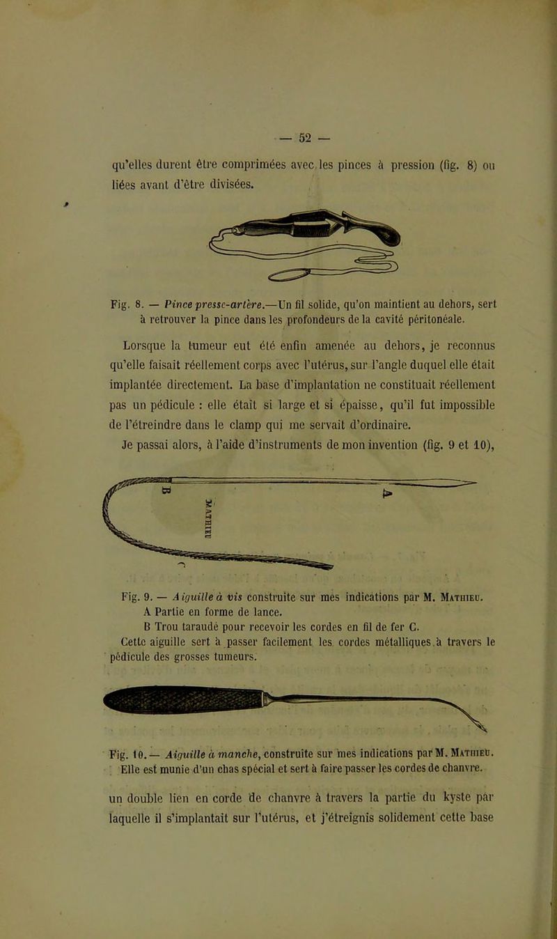 qu’elles durent être comprimées avec, les pinces à pression (fig. 8) ou liées avant d’être divisées. Fig. 8. — Pince presse-artère.—Un fil solide, qu’on maintient au dehors, sert à retrouver la pince dans les profondeurs de la cavité péritonéale. Lorsque la tumeur eut été enfin amenée au dehors, je reconnus qu’elle faisait réellement corps avec l’utérus, sur l’angle duquel elle était implantée directement. La base d’implantation ne constituait réellement pas un pédicule : elle était si large et si épaisse, qu’il fut impossible de l’étreindre dans le clamp qui me servait d’ordinaire. Je passai alors, à l’aide d’instruments de mon invention (fig. 9 et 10), Fig. 9. — .4 iguille à vis construite sur mes indications par M. Mathieu. A Partie en forme de lance. B Trou taraudé pour recevoir les cordes en fil de fer G. Cette aiguille sert à passer facilement les cordes métalliques,h travers le pédicule des grosses tumeurs. Fig. 10.— Aiguille à manche, construite sur mes indications par M. Mathieu. Elle est munie d’un chas spécial et sert à faire pas.ser les cordes de chanvre. un double lien en corde de chanvre à travers la partie du kyste par laquelle il s’implantait sur l’utérus, et j’étreignis solidement cette base