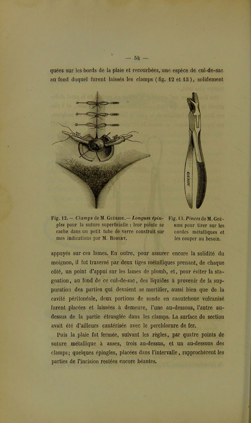 — 5/1 quées sur les bords de la plaie et recourbées, une espèce de cul-de-sac au fond duquel furent laissés les clamps {fig. 12 et 13), solidement Fig. 12.— C/ampi de M.GuÉniDE.—Longues épm- Fig. 13. Pinces de M.Gdé- gles pour la suture superflcielle : leur pointe se iude pour tirer sur les cache dans un petit tube de verre construit sur cordes métalliques et mes indications par M. Robeiit. les couper au besoin. appuyés sur ces lames. En outre, pour assurer encore la solidité du moignon, il fut traversé par deux tiges métalliques prenant, de chaque côté, un point d’appui sur les lames de plomb, et, pour éviter la sta- gnation , au fond de ce cul-de-sac, des liquides à provenir de la sup- puration des parties qui devaient se mortifier, aussi bien que de la cavité péritonéale, deux portions de sonde en caoutchouc vulcanisé furent placées et laissées à demeure, l’une au-dessous, l’autre au- dessus de la partie étranglée dans les clamps. La surface de section avait été d’ailleurs cautérisée avec le perchlorure de fer. Puis la plaie fut fermée, suivant les règles, par quatre points de suture métallique à anses, trois au-dessus, et un au-dessous des clamps; quelques épingles, placées dans l’intervalle, rapprochèrent les parties de l’incision restées encore béantes.