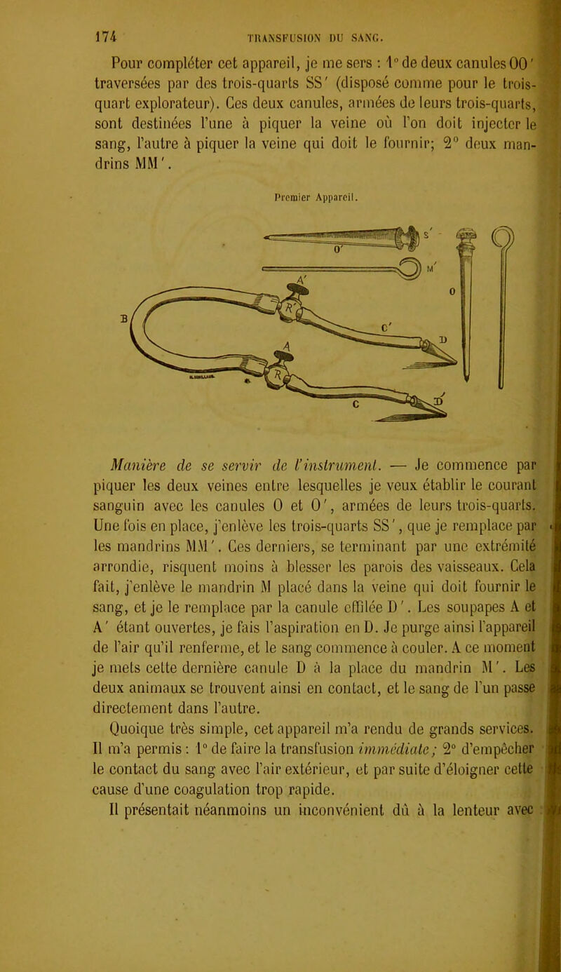 Pour compléter cet appareil, je me sers : 1“ de deux canules 00 ' traversées par des trois-quarts SS' (disposé comme pour le trois-^ quart explorateur). Ces deux canules, armées de leurs trois-quarfs,i sont destinées Tune à piquer la veine où l’on doit injecter le sang, l’autre à piquer la veine qui doit le fournir; 2“ deux man- drins MM '. Premier Appareil. Manière de se servir de l’inslrunienl. — Je commence par piquer les deux veines entre lesquelles je veux établir le courant sanguin avec les canules 0 et 0', armées de leurs trois-quarts. Une fois en place, j’enlève les trois-quarts SS', que je remplace par les mandrins M.\l'. Ces derniers, se terminant par une extrémité arrondie, risquent moins à blesser les parois des vaisseaux. Cela fait, j’enlève le mandrin M placé dans la veine qui doit fournir le sang, et je le remplace par la canule effilée D '. Les soupapes A et A' étant ouvertes, je fais l’aspiration en D. Je purge ainsi l’appareil de l’air qu’il renferme, et le sang commence à couler. A ce moment je mets cette dernière canule D à la place du mandrin M'. Les deux animaux se trouvent ainsi en contact, et le sang de l’un passe directement dans l’autre. Quoique très simple, cet appareil m’a rendu de grands services. Il m’a permis : 1“ de faire la transfusion immédiate; 2® d’empêcher le contact du sang avec l’air extérieur, et par suite d’éloigner cettè cause d’une coagulation trop rapide. Il présentait néanmoins un inconvénient dû ù la lenteur avec