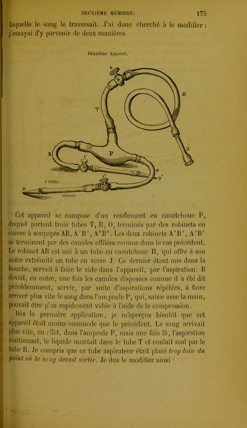 laquelle le sang le traversait. J’ai donc cherché à le modifier : j’essayai d’y parvenir de deu.v manières. Deuxième Appareil. Cet appareil se compose d’un renfiement en caoutchouc P, duquel partent trois tubes T, R, O, terminés par des robinets en cuivre à soupapes AB, A'B', AB. Les deux robinets A'B', AB J se terminent par des canules effilées comme dans le cas précédent. I Le robinet AB est uni à un tube en caoutchouc II, qui offre à son < autre extrémité un tube en verre J. Ce dernier étant mis dans la ;i bouebe, servait à faire le vide dans l’appareil, par l’aspiration. Il I devait, en outre, une fois les canules disposées comme il a été dit précédemment, servir, par suite d’aspirations répétées, à faire 1 arriver plus vite le sang dans l’am poule P, qui, saisie avec la main, d pouvait être plus rapidement vidée è l’aide de la compression. Dès la première application, je m’aperçus bientôt que cet *1 appareil était moins commode que 1e précédent. Le sang arrivait il plus vite, en effet, dans l’ampoule P, mais une fois là, l’aspiration k continuant, le liquide montait dans le tube T et coulait mal par le 1. tube R. Je compris que ce tube aspirateur était placé trop loin du ’ point où le sang devait sortir. Je dus le modifier ainsi •