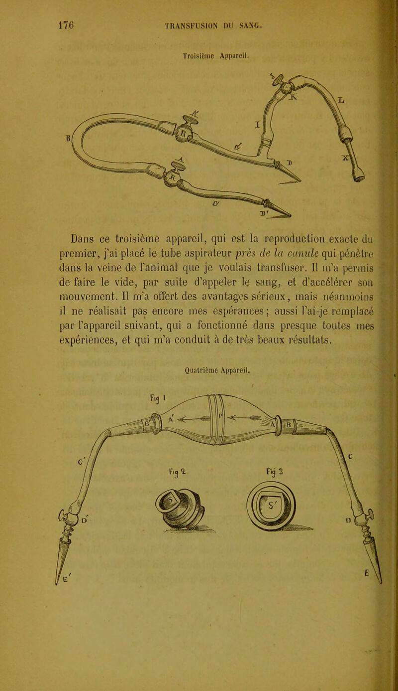 Troisième Appareil. Dans ce troisième appareil, qui est la reproduction exacte du premier, j’ai placé le tube aspirateur près de la camde qui pénètre dans la veine de l’animal que je voulais transfuser. 11 m’a permis de faire le vide, par suite d’appeler le sang, et d’accélérer son mouvement. Il m’a offert des avantages sérieux, mais néanmoins il ne réalisait pas encore mes espérances ; aussi l’ai-je remplacé par l’appareil suivant, qui a fonctionné dans presque toutes mes expériences, et qui m’a conduit à de très beaux résultats. Quatrième Appareil. /