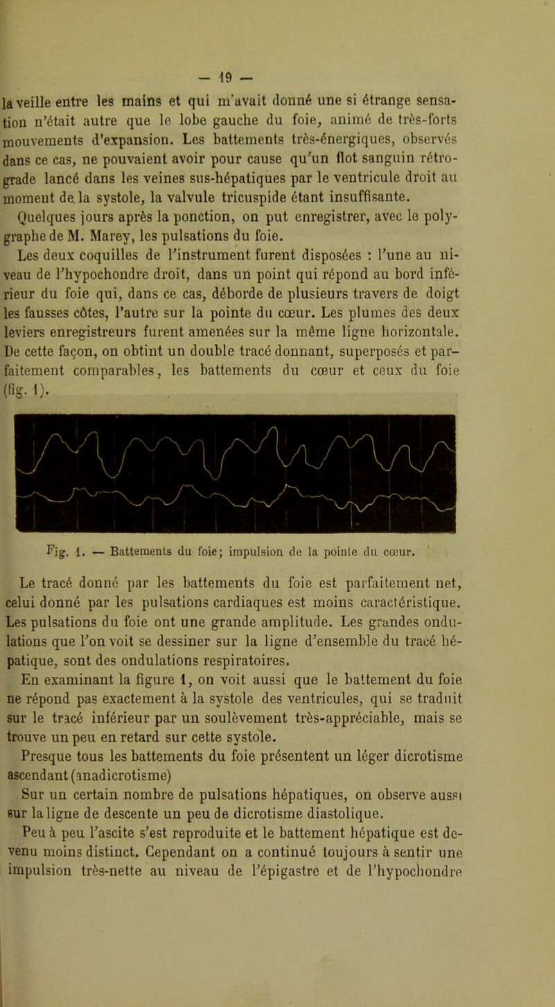 la veille entre les mains et qui m'avait donné une si étrange sensa- tion n’était autre que le lobe gauche du foie, animé de très-forts mouvements d’expansion. Les battements très-énergiques, observés dans ce cas, ne pouvaient avoir pour cause qu’un flot sanguin rétro- grade lancé dans les veines sus-hépatiques par le ventricule droit au moment de. la systole, la valvule tricuspide étant insuffisante. Quelques jours après la ponction, on put enregistrer, avec le poly- graphede M. Marey, les pulsations du foie. Les deux coquilles de l’instrument furent disposées : l’une au ni- veau de l’hypochondre droit, dans un point qui répond au bord infé- rieur du foie qui, dans ce cas, déborde de plusieurs travers de doigt les fausses côtes, l’autre sur la pointe du cœur. Les plumes des deux leviers enregistreurs furent amenées sur la même ligne horizontale. De cette façon, on obtint un double tracé donnant, superposés et par- faitement comparables, les battements du cœur et ceux du foie (fig- *)• Fig. 1. — Battements du foie; impulsion de la pointe du cœur. Le tracé donné par les battements du foie est parfaitement net, celui donné par les pulsations cardiaques est moins caractéristique. Les pulsations du foie ont une grande amplitude. Les grandes ondu- lations que l’on voit se dessiner sur la ligne d’ensemble du tracé hé- patique, sont des ondulations respiratoires. En examinant la figure 1, on voit aussi que le battement du foie ne répond pas exactement à la systole des ventricules, qui se traduit sur le tracé inférieur par un soulèvement très-appréciable, mais se trouve un peu en retard sur cette systole. Presque tous les battements du foie présentent un léger dicrotisme ascendant (anadicrotisme) Sur un certain nombre de pulsations hépatiques, on observe aussi sur la ligne de descente un peu de dicrotisme diastolique. Peu à peu l’ascite s’est reproduite et le battement hépatique est de- venu moins distinct. Cependant on a continué toujours à sentir une impulsion très-nette au niveau de l’épigastre et de l’hypochondre