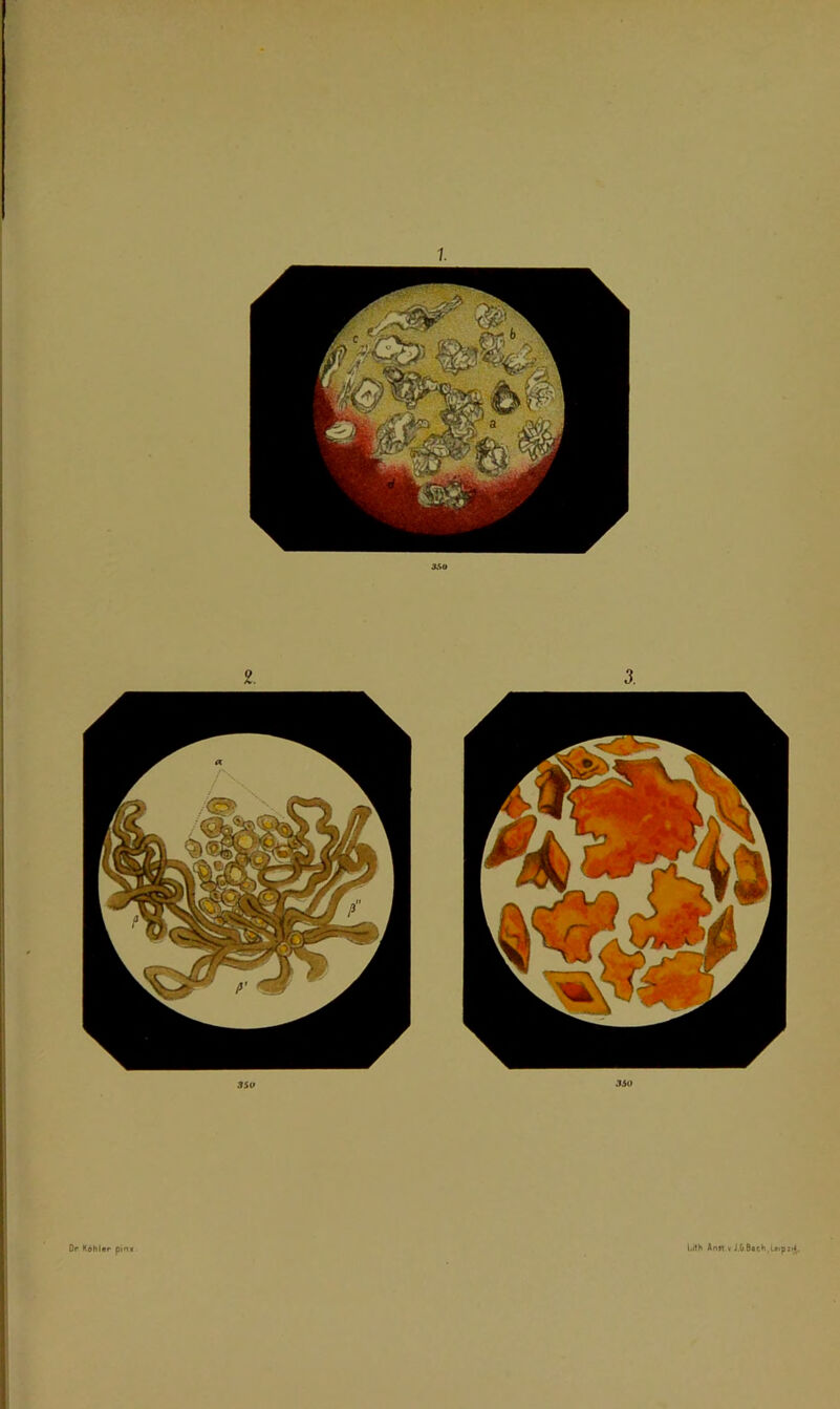 1. 35 U WO Op Köhler pin* l.ith Ann »J.6Bach,L*ip:^.