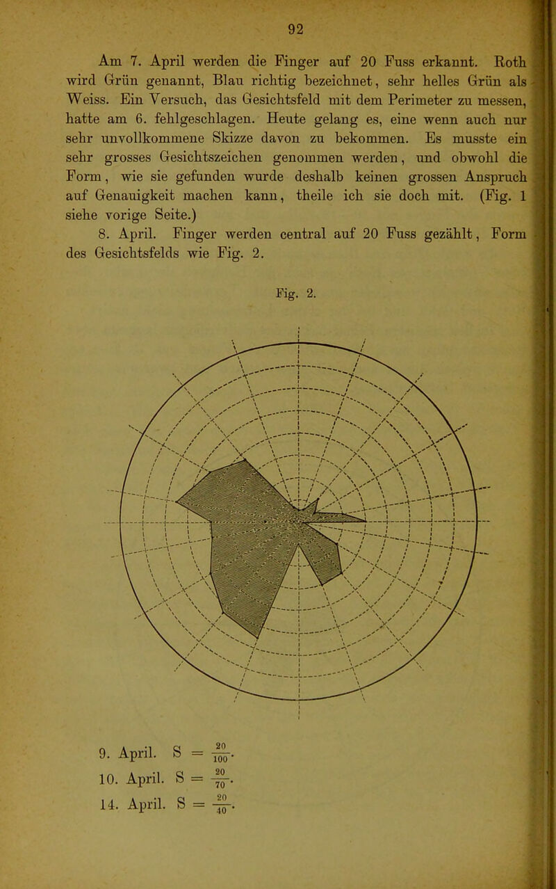 Am 7. April werden die Finger auf 20 Fuss erkannt. Roth I wird Grün genannt, Blau richtig bezeichnet, sehr helles Grün als J Weiss. Ein Versuch, das Gesichtsfeld mit dem Perimeter zu messen, i hatte am 6. fehlgeschlagen. Heute gelang es, eine wenn auch nur j sehr unvollkommene Skizze davon zu bekommen. Es musste ein I sehr grosses Gesichtszeichen genommen werden, und obwohl die Form, wie sie gefunden wurde deshalb keinen grossen Anspruch J auf Genauigkeit machen kann, theile ich sie doch mit. (Fig. 1 siehe vorige Seite.) | 8. April. Finger werden central auf 20 Fuss gezählt, Form des Gesichtsfelds wie Fig. 2. Fig. 2. 9. April. S = ^. 10. April. S = 14. April. S =