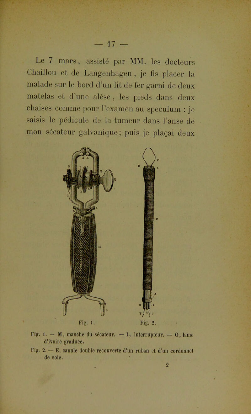 Le 7 mars, assisté par MM. les docteurs Chaillou et de Laiigenhagen , je fis placer la malade sur le bord d’un lit de fer garni de deux matelas et d’une alèse, les pieds dans deux chaises comme pour l’examen au spéculum : je saisis le pédicule de la tumeur dans l’anse de mon sécateur galvanique; puis je plaçai deux Fig. 1. Fig. 2. Fig. 1. — M, manche du sécateur. — 1, interrupteur. — O, lame d’ivoire graduée. Fig. 2. — E, canule double recouverte d’un ruban et d’un cordonnet de soie. -2