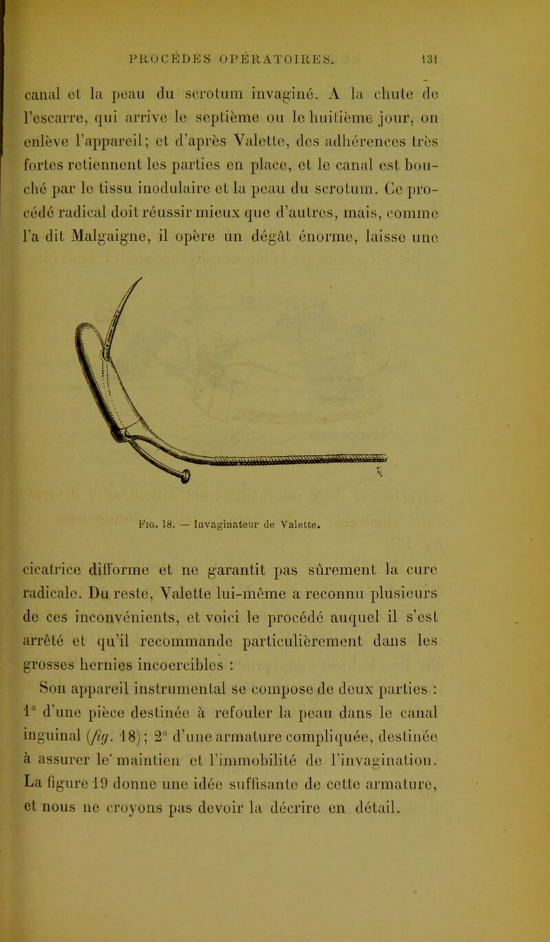 canal cl la peau du scrotum invaginé. A la chute de l’escarre, qui arrive le septième ou le huitième jour, on enlève l’appareil; et d'après Valette, des adhérences très fortes retiennent les parties en place, et le canal est bou- ché par le tissu modulaire et la peau du scrotum. Ce pro- cédé radical doit réussir mieux que d’autres, mais, comme l’a dit Malgaigne, il opère un dégât énorme, laisse une Fig. 18. — Invaginateur de Valette. cicatrice difforme et ne garantit pas sûrement la cure radicale. Du reste, Valette lui-même a reconnu plusieurs de ces inconvénients, et voici le procédé auquel il s’est arrêté et qu’il recommande particulièrement dans les grosses hernies incoercibles : Son appareil instrumental se compose de deux parties : 1° d’une pièce destinée à refouler la peau dans le canal inguinal (fuj. 18); 2° d’une armature compliquée, destinée à assurer le maintien et l’immobilité de l’invagination. La ligure 19 donne une idée suffisante de celte armature, et nous ne croyons pas devoir la décrire en détail.